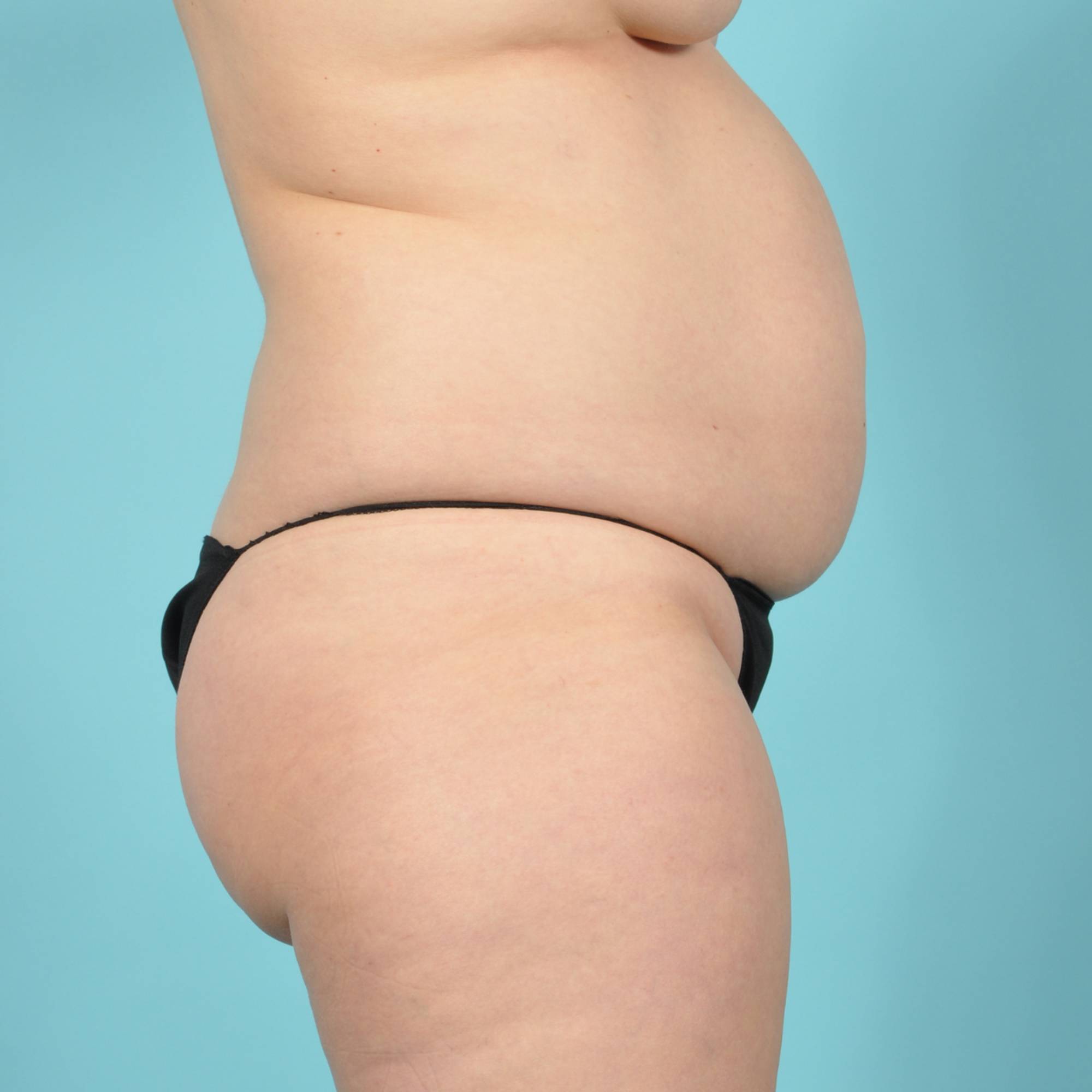  Before & After Image