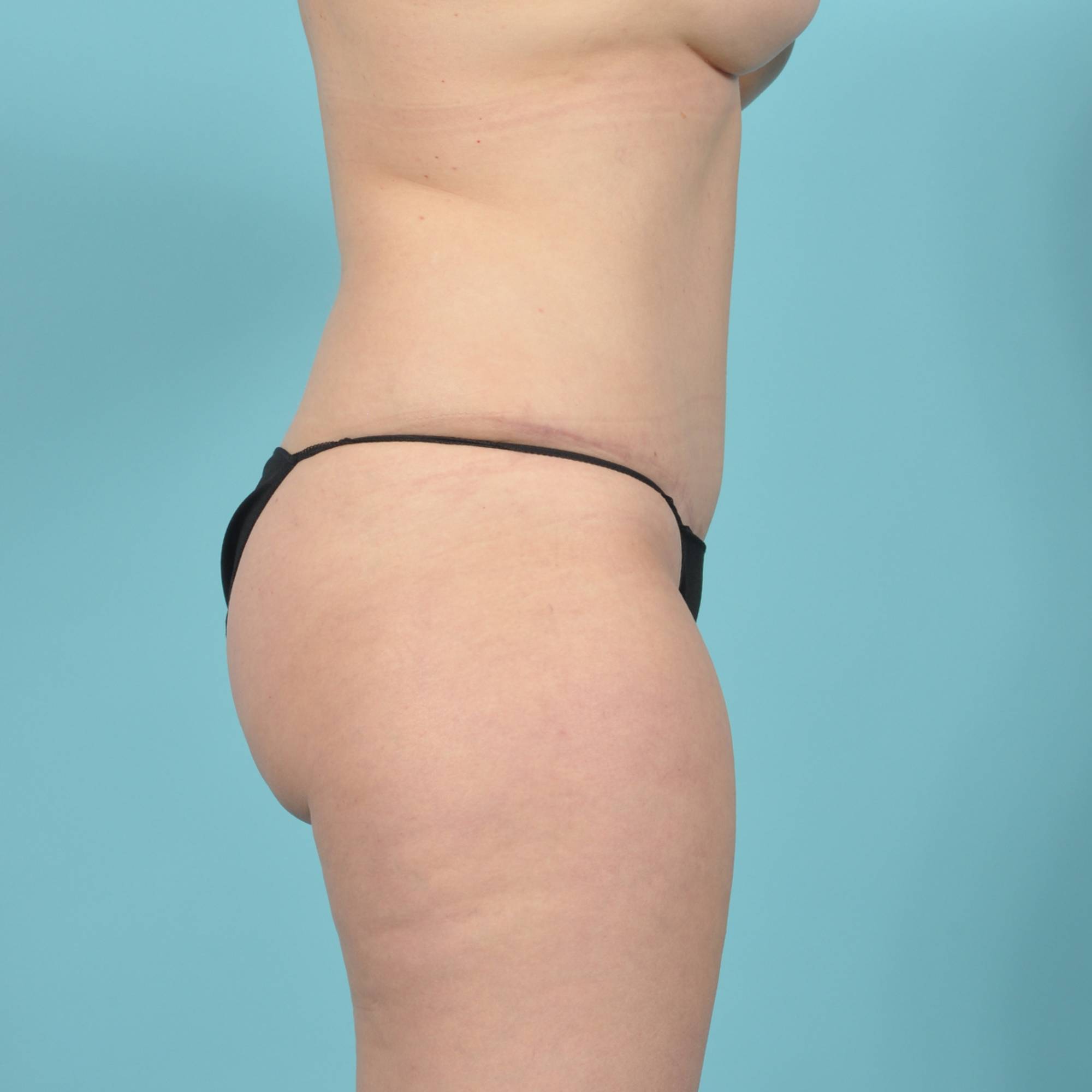  Before & After Image