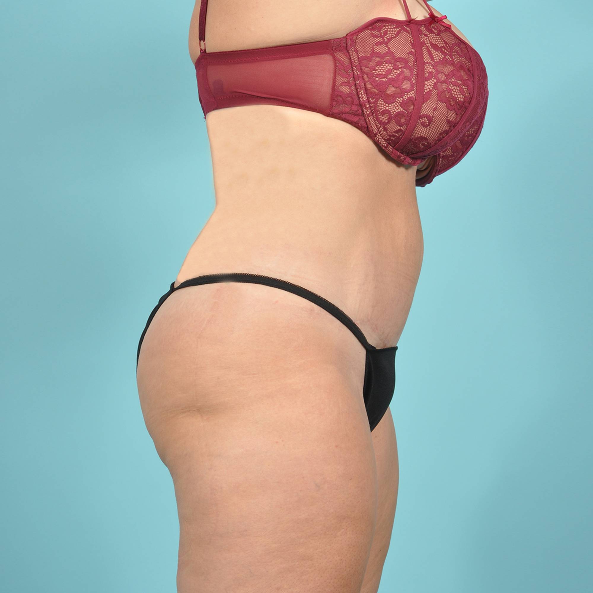  Before & After Image