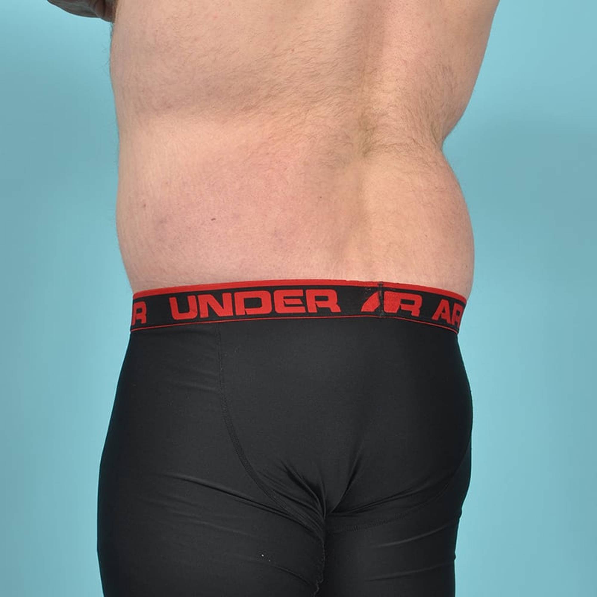  Before & After Image