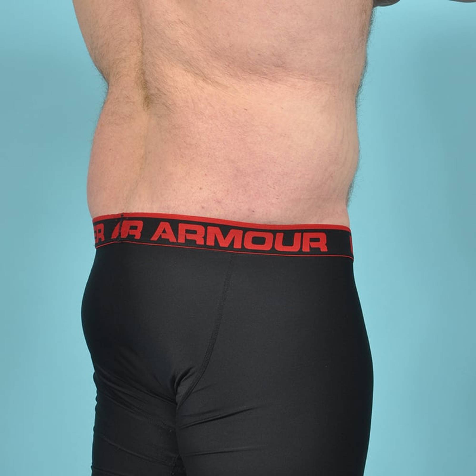  Before & After Image