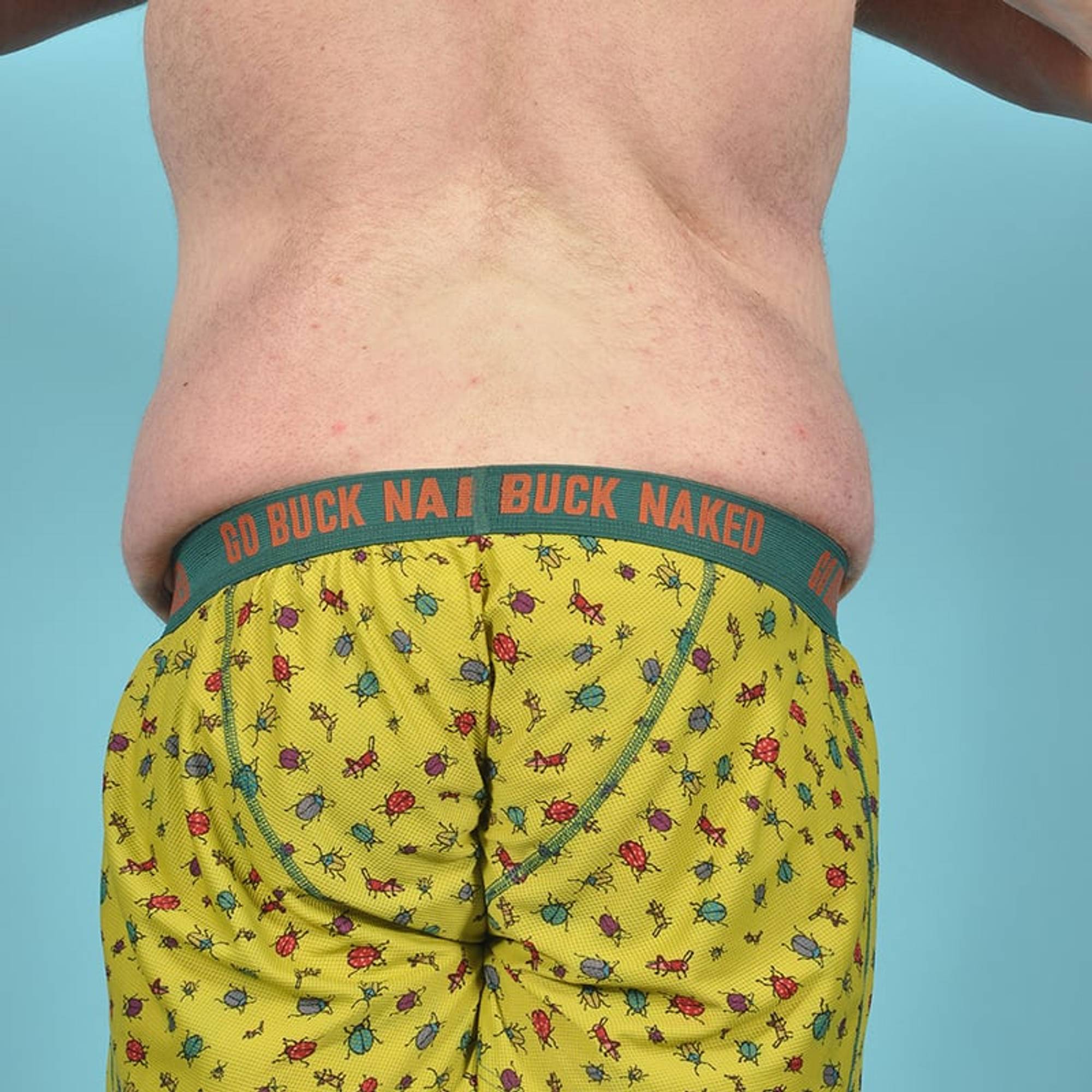  Before & After Image