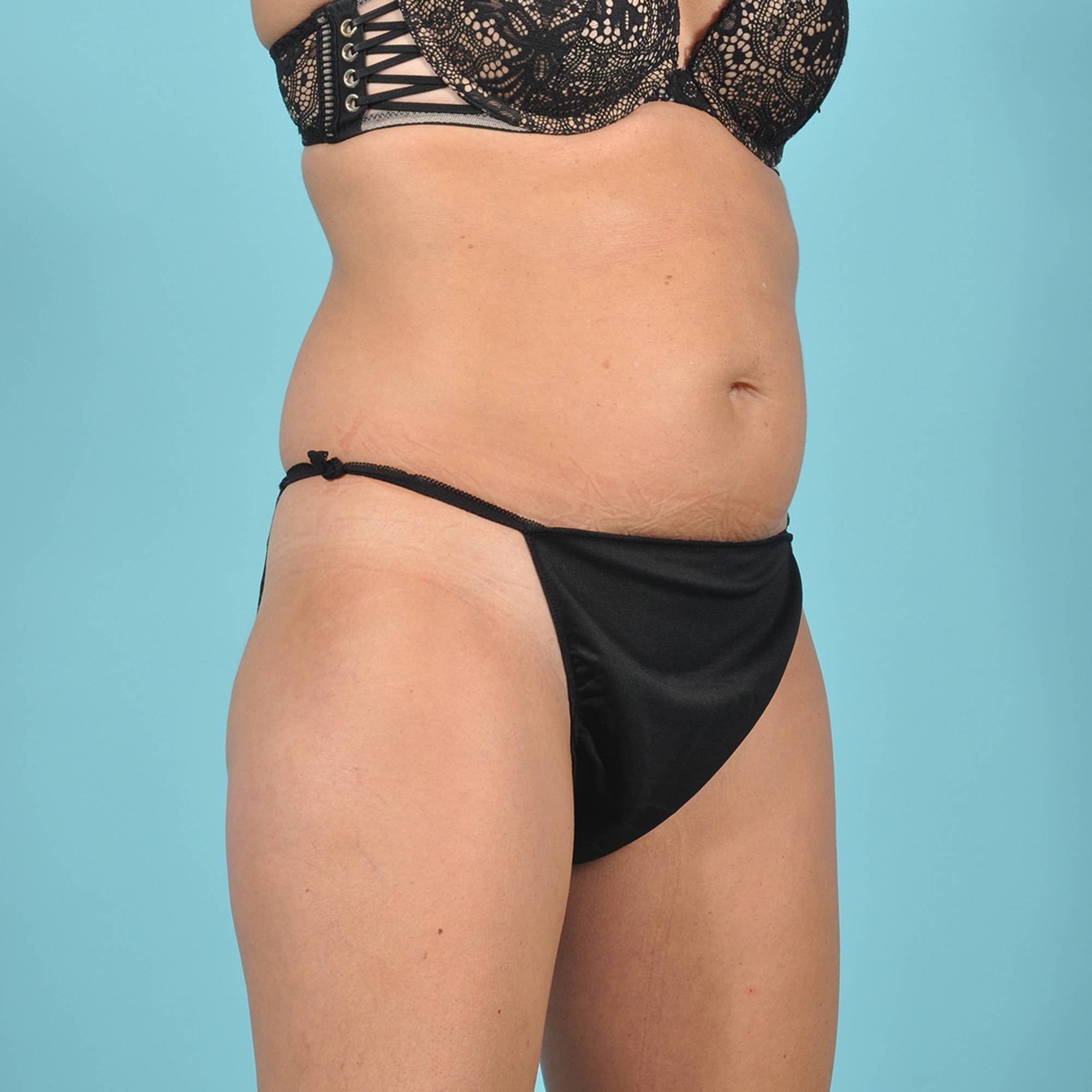  Before & After Image