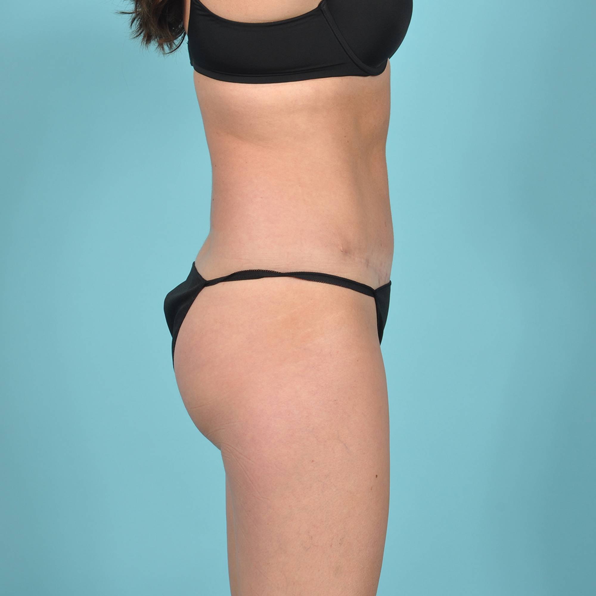  Before & After Image