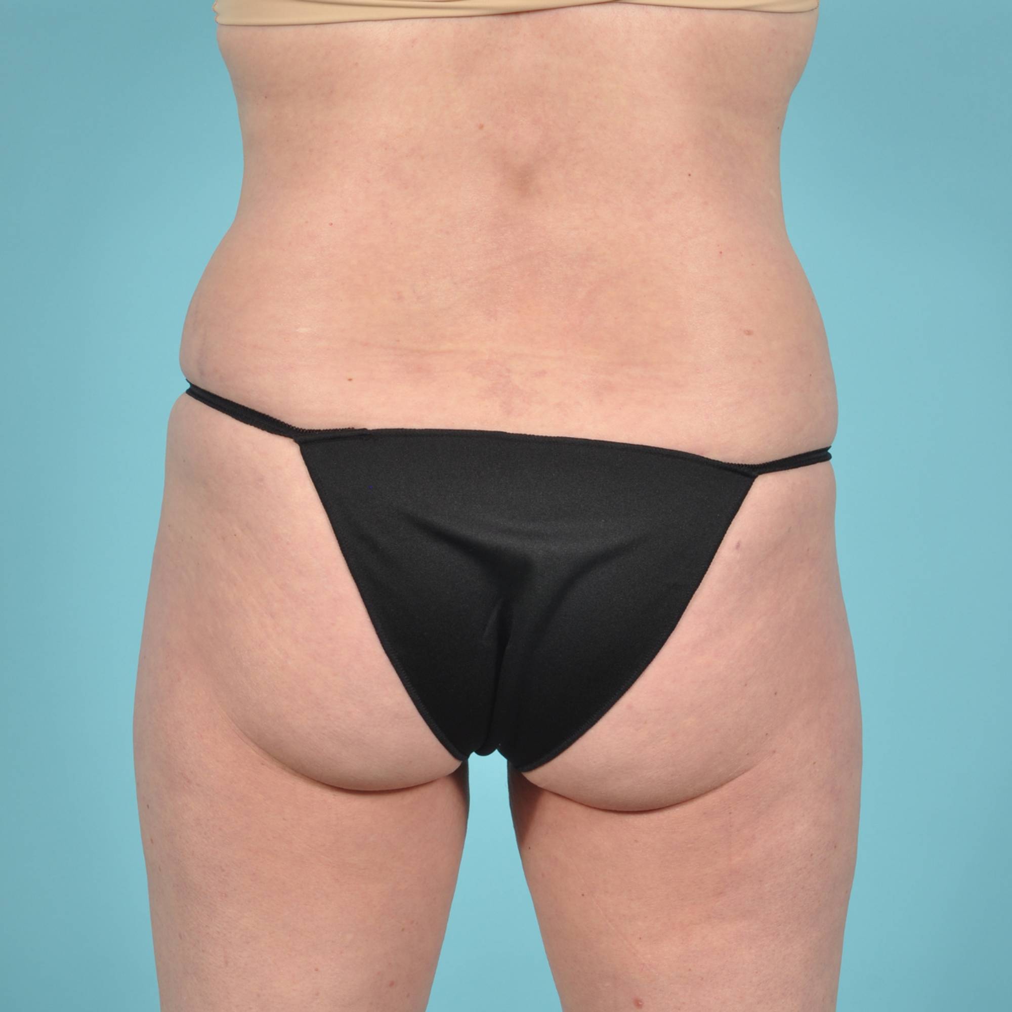  Before & After Image