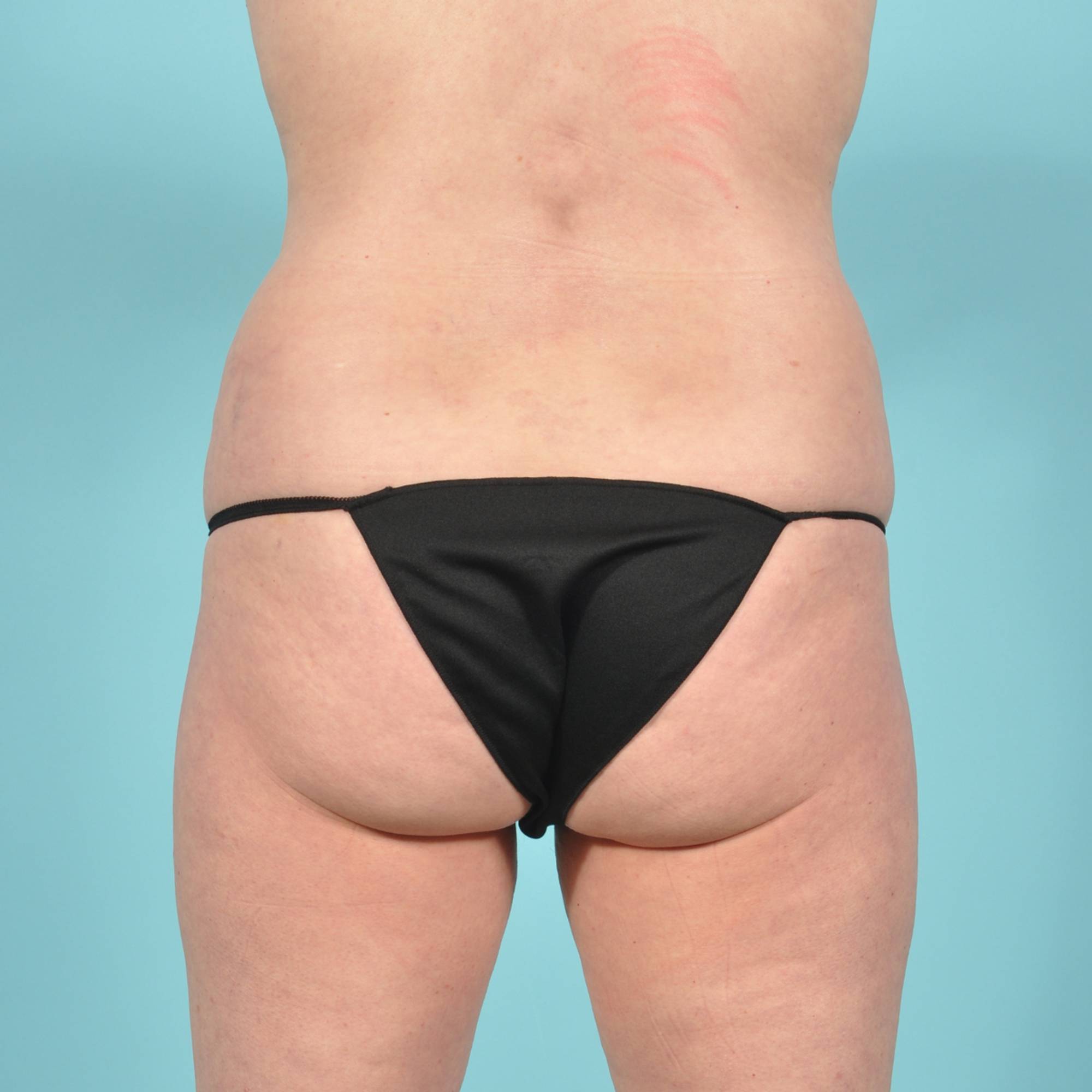  Before & After Image