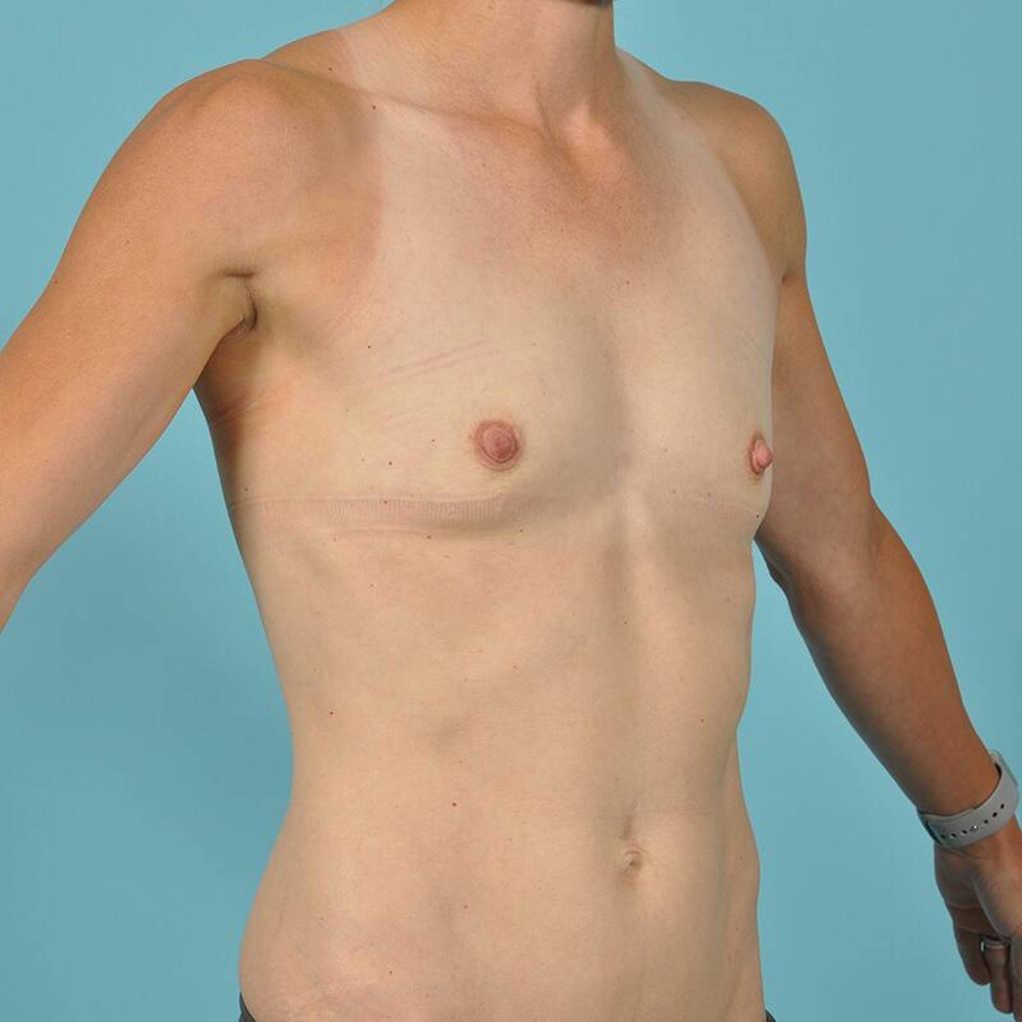  Before & After Image