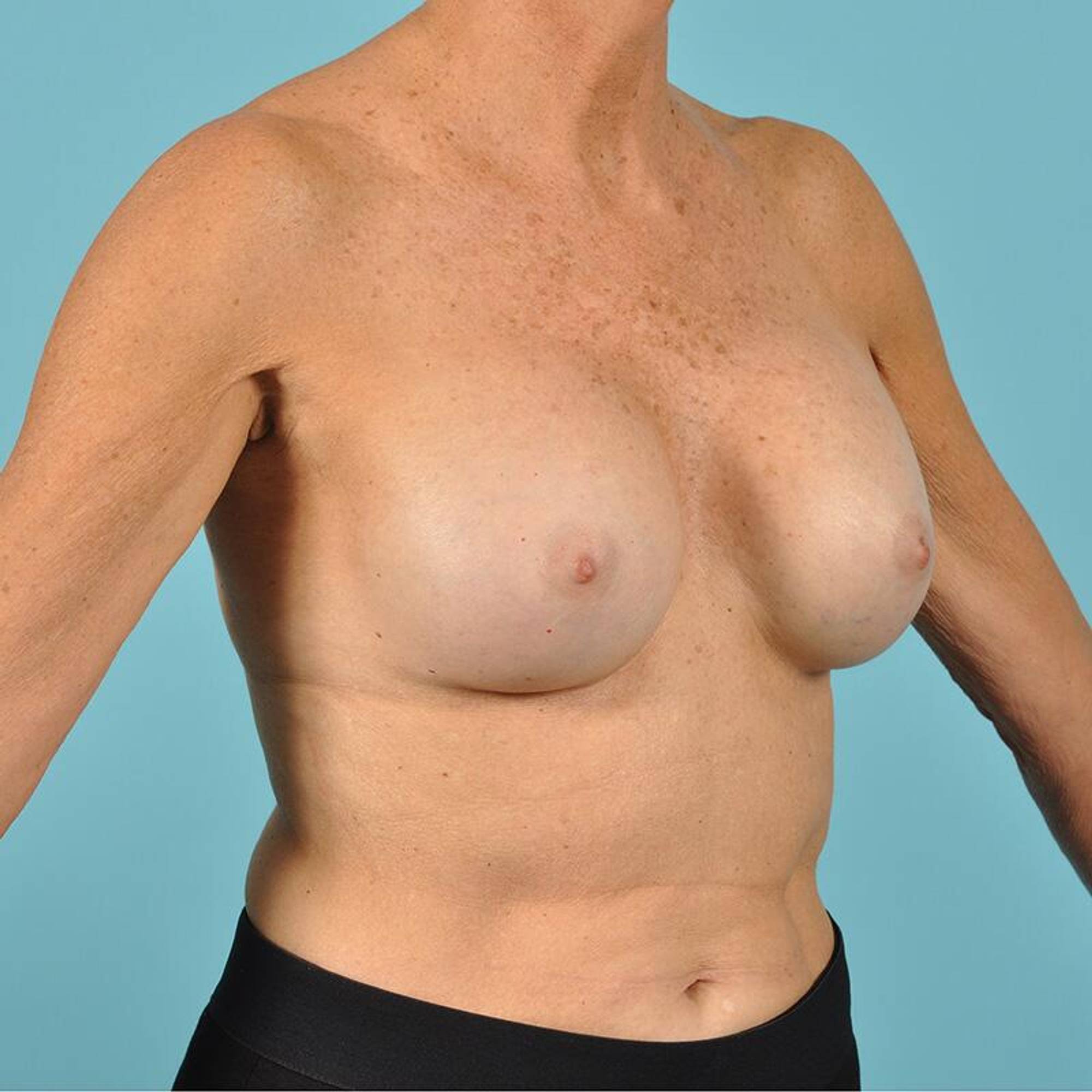  Before & After Image