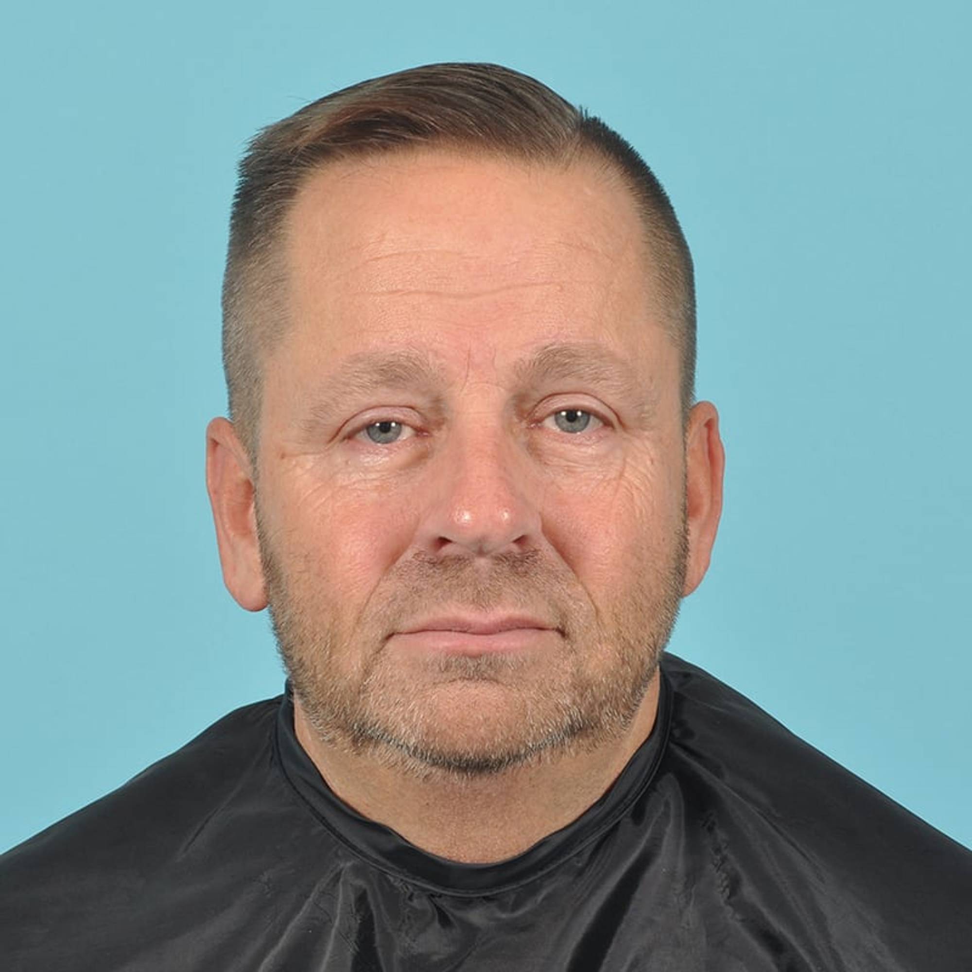 Blepharoplasty Before & After Image