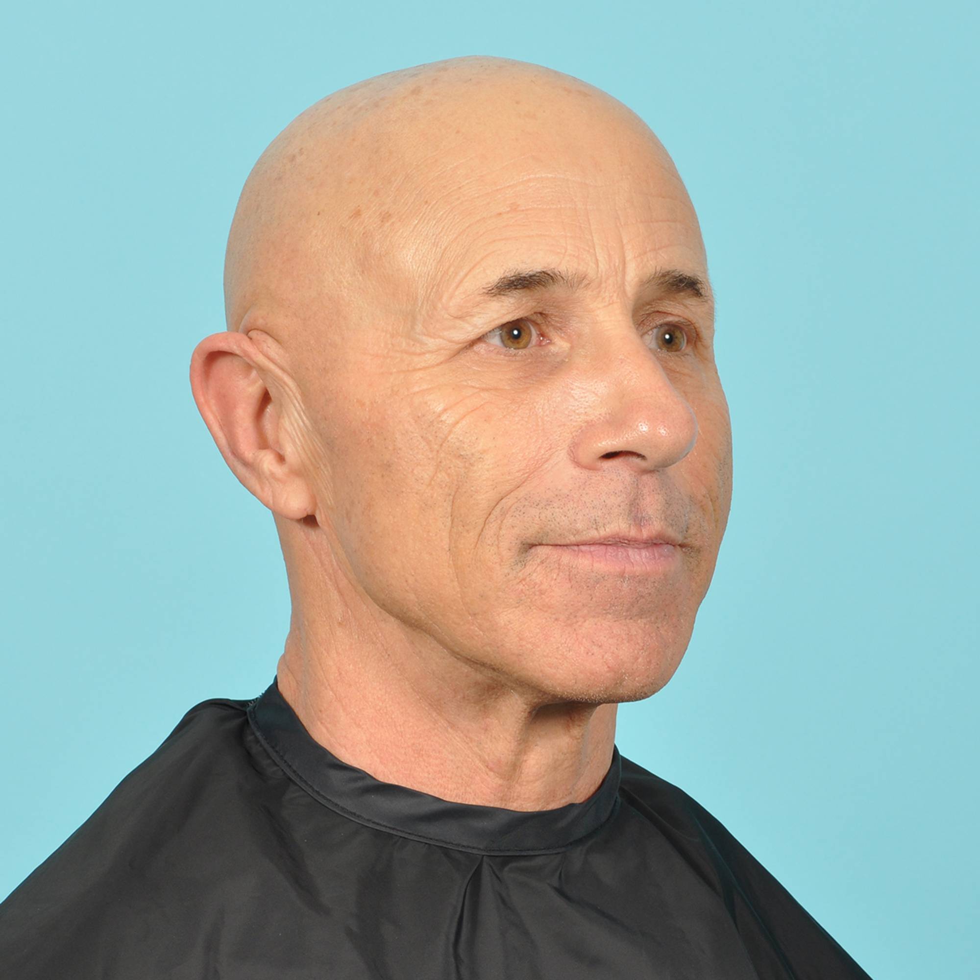  Before & After Image