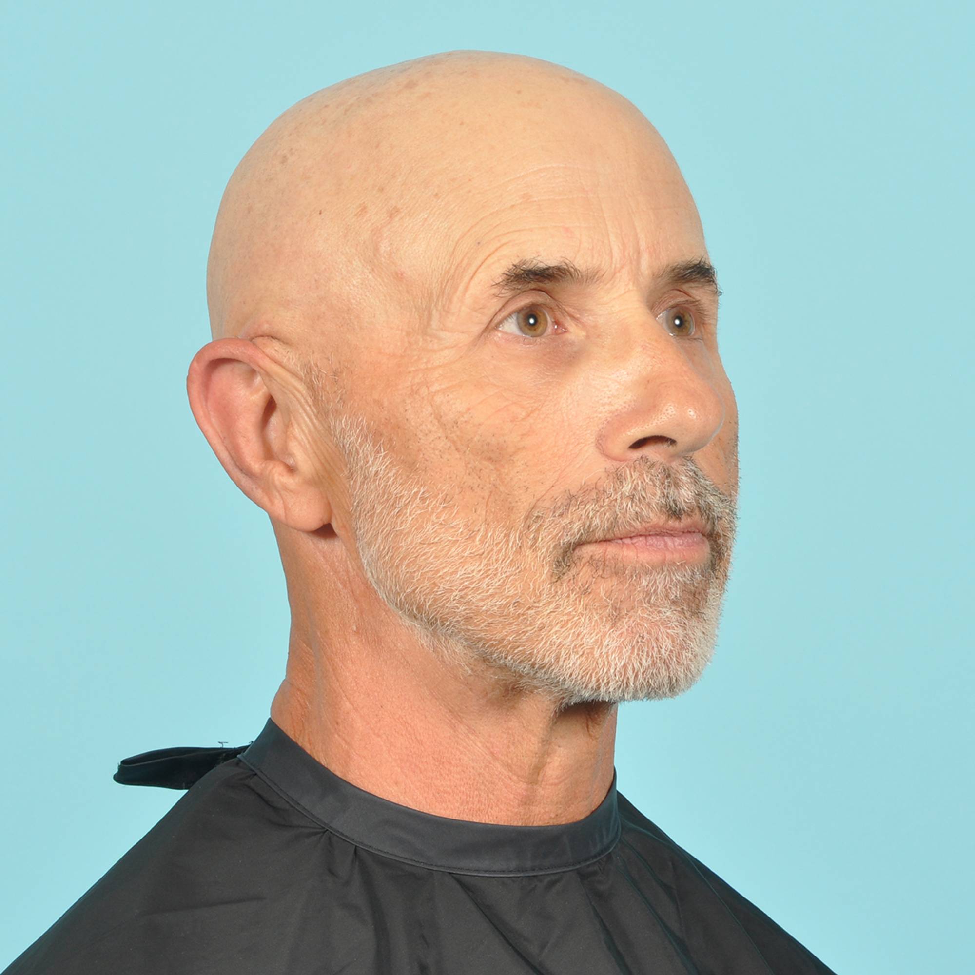  Before & After Image