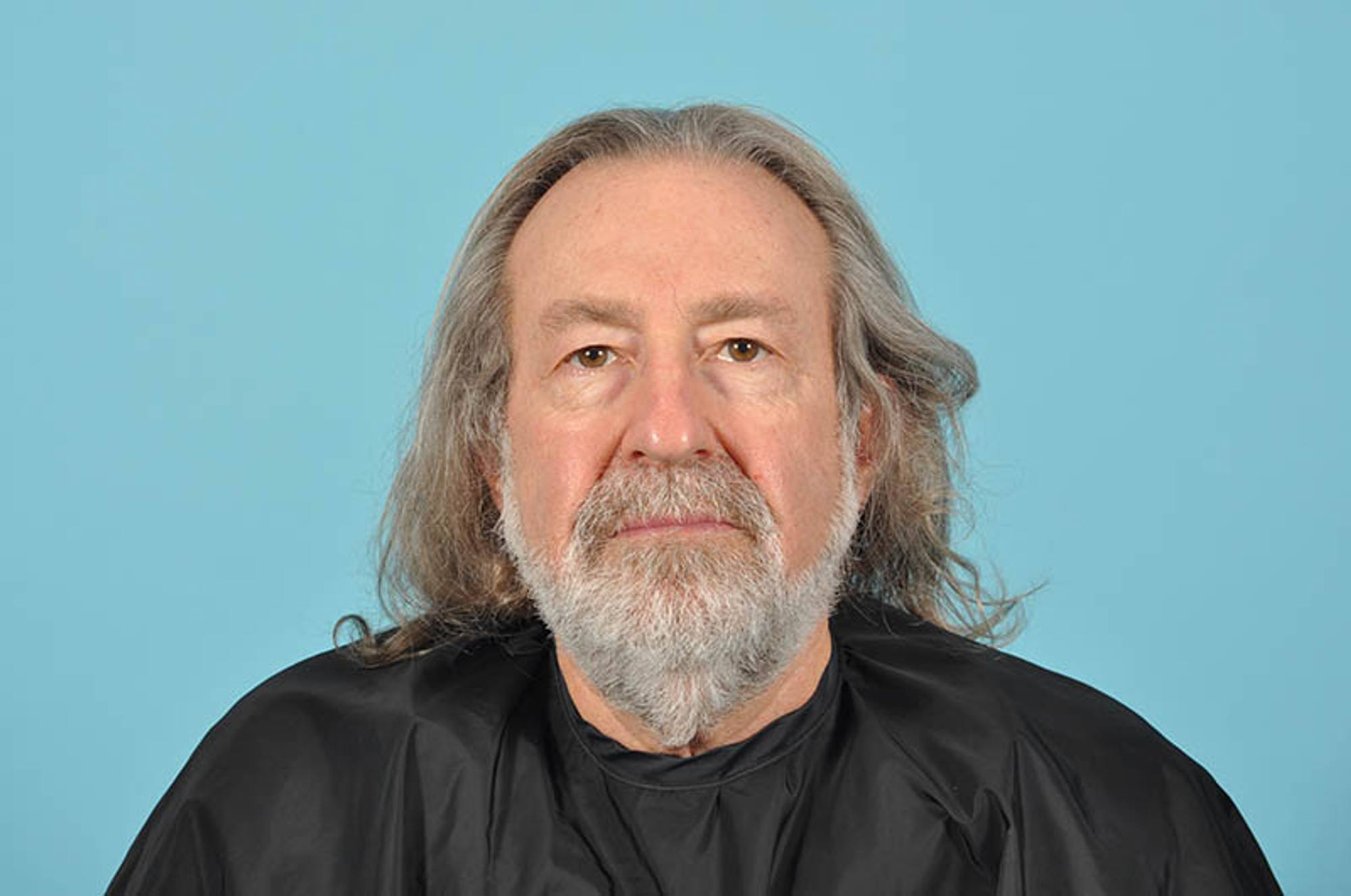 Blepharoplasty Before & After Image