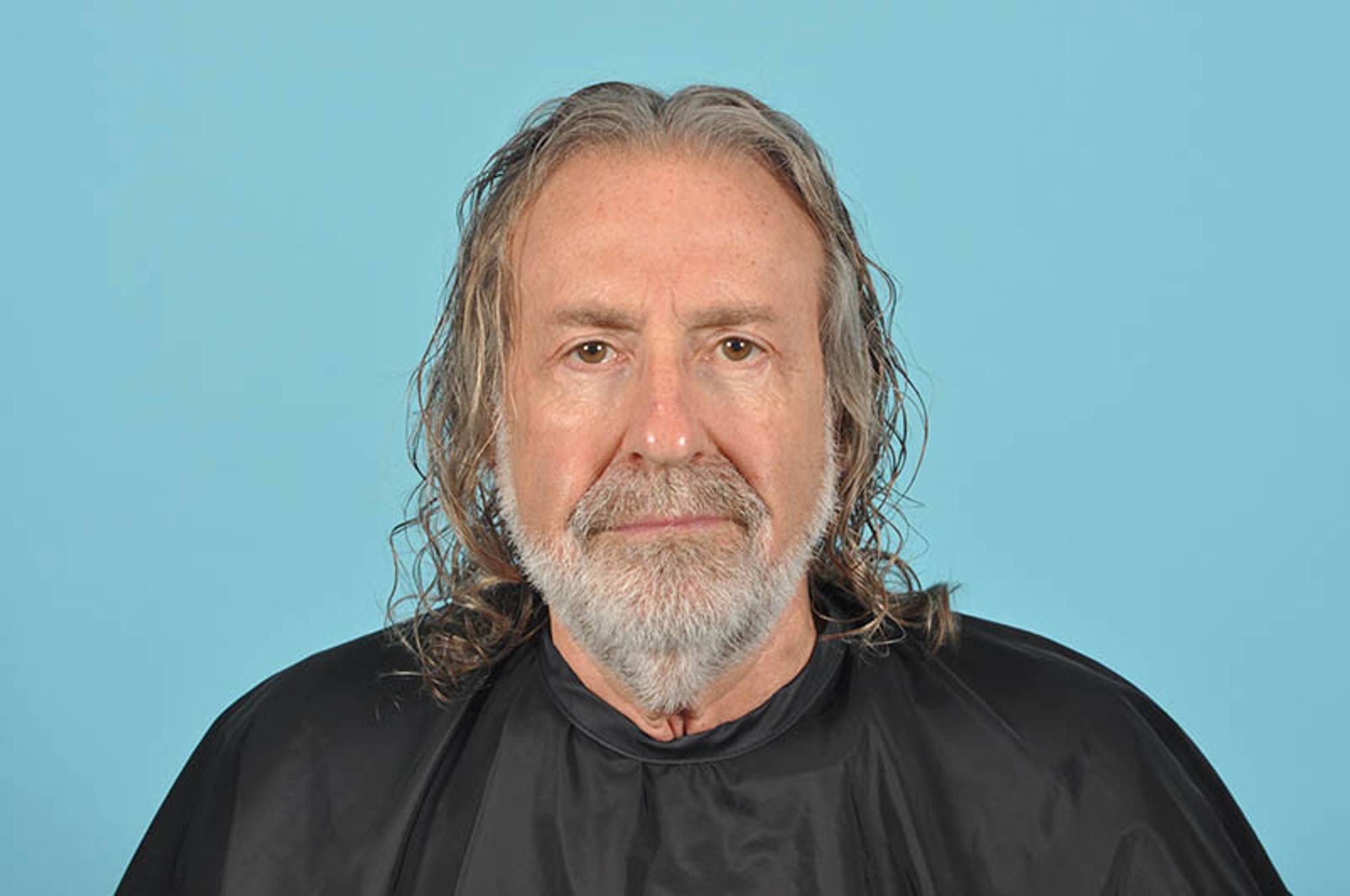 Blepharoplasty Before & After Image