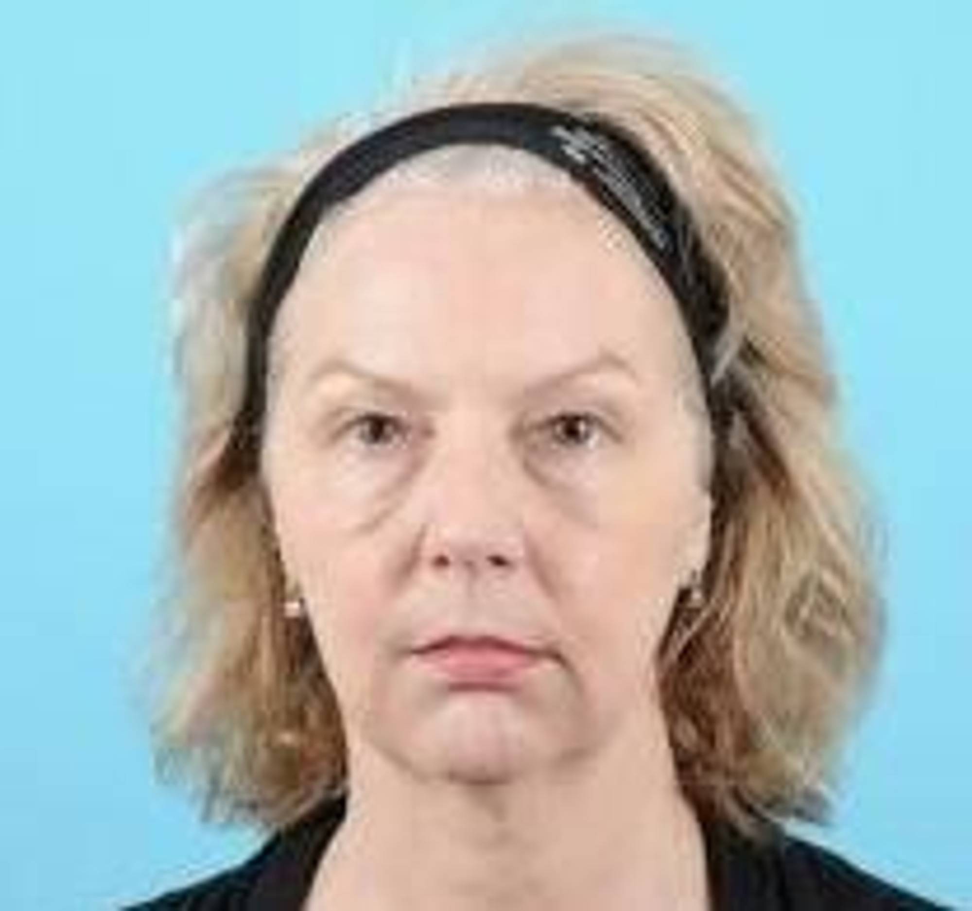 Blepharoplasty Before & After Image