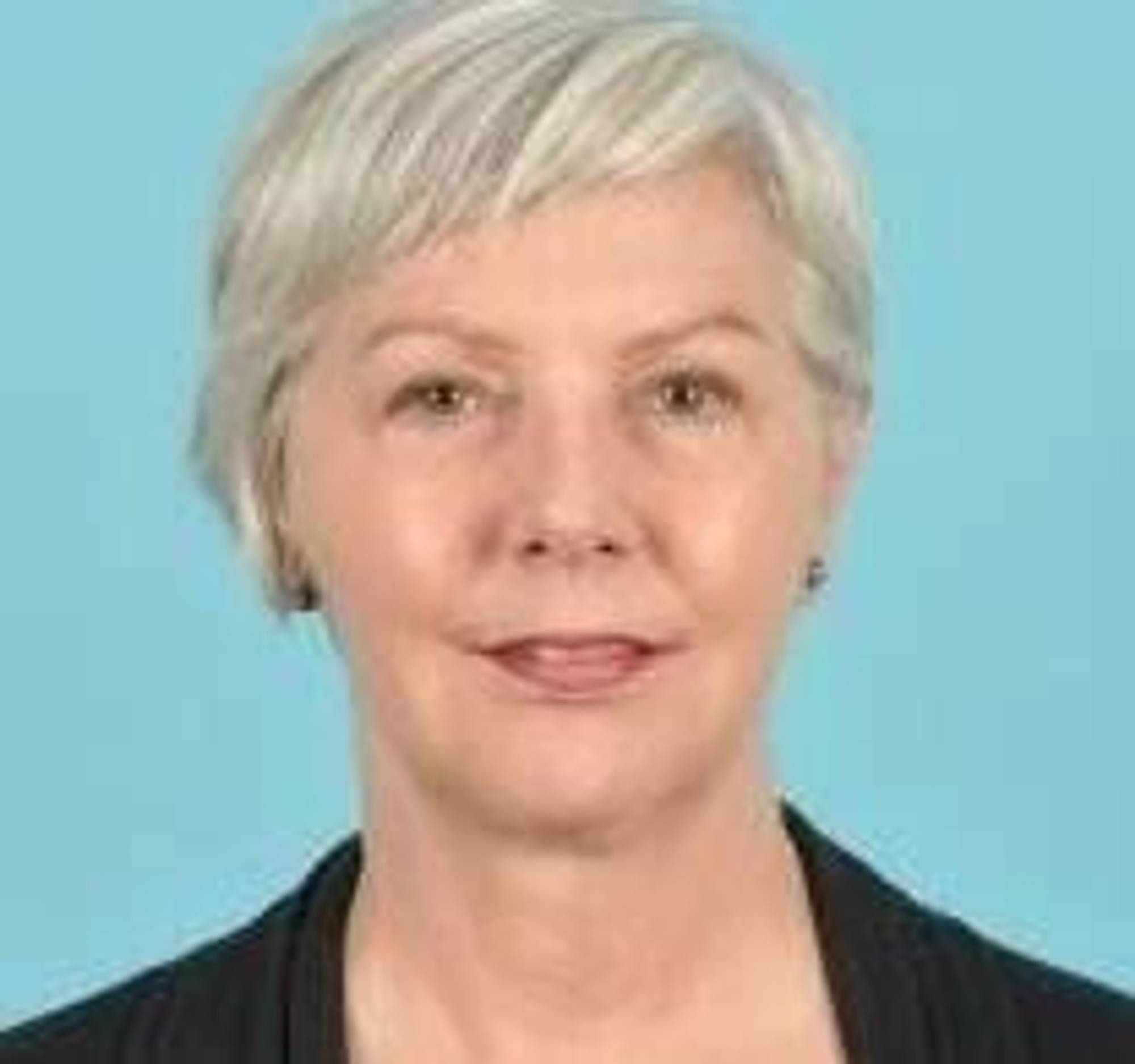 Blepharoplasty Before & After Image