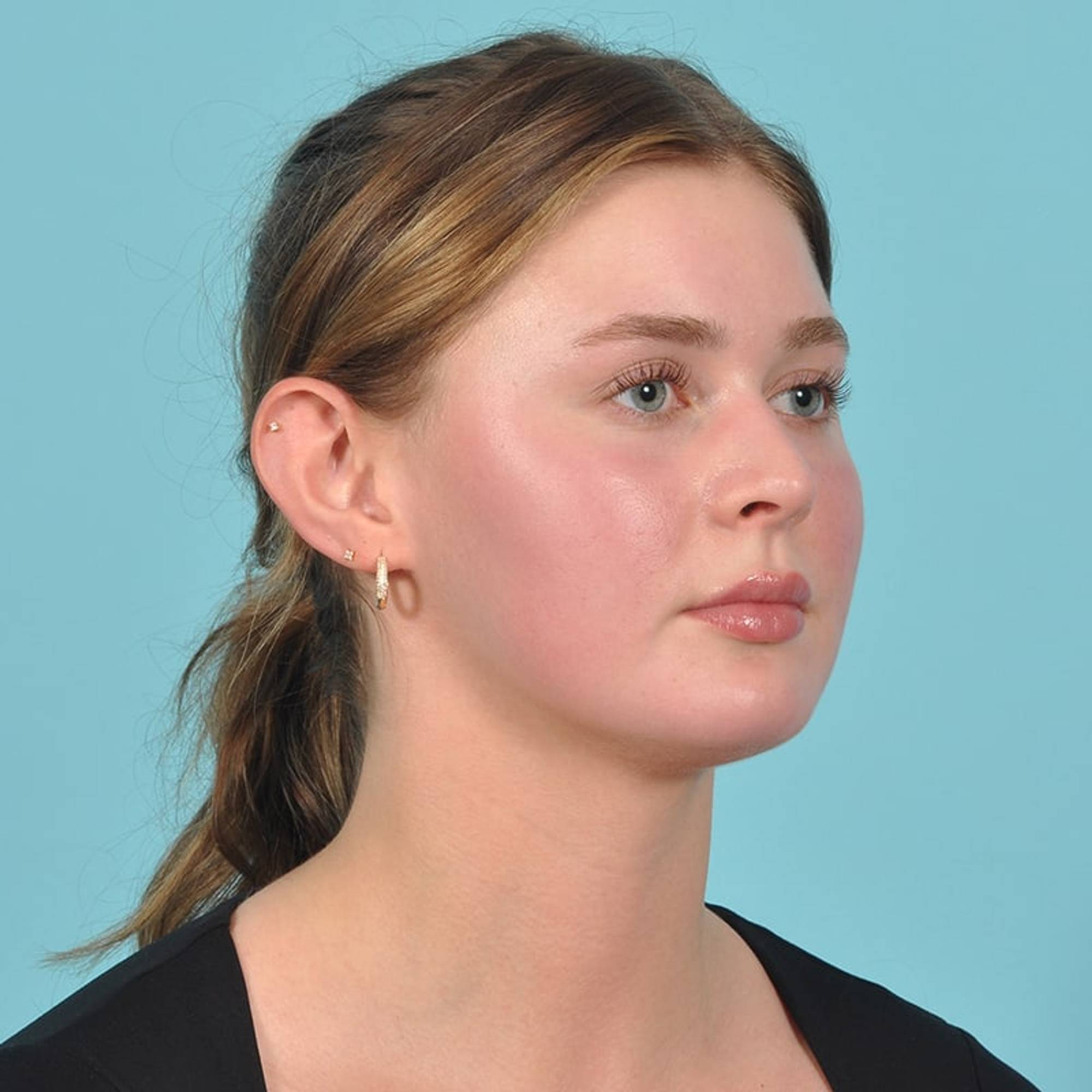  Before & After Image