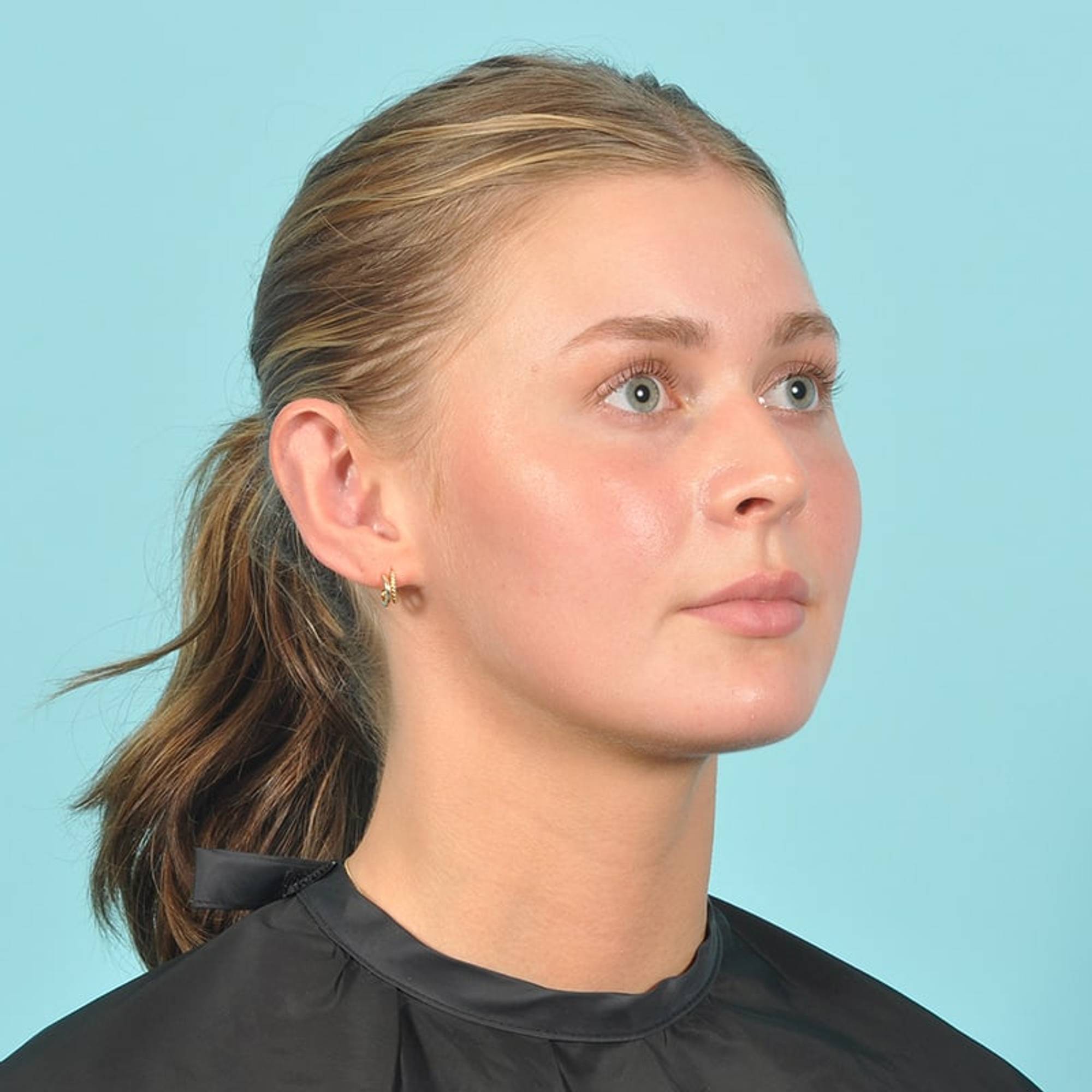  Before & After Image