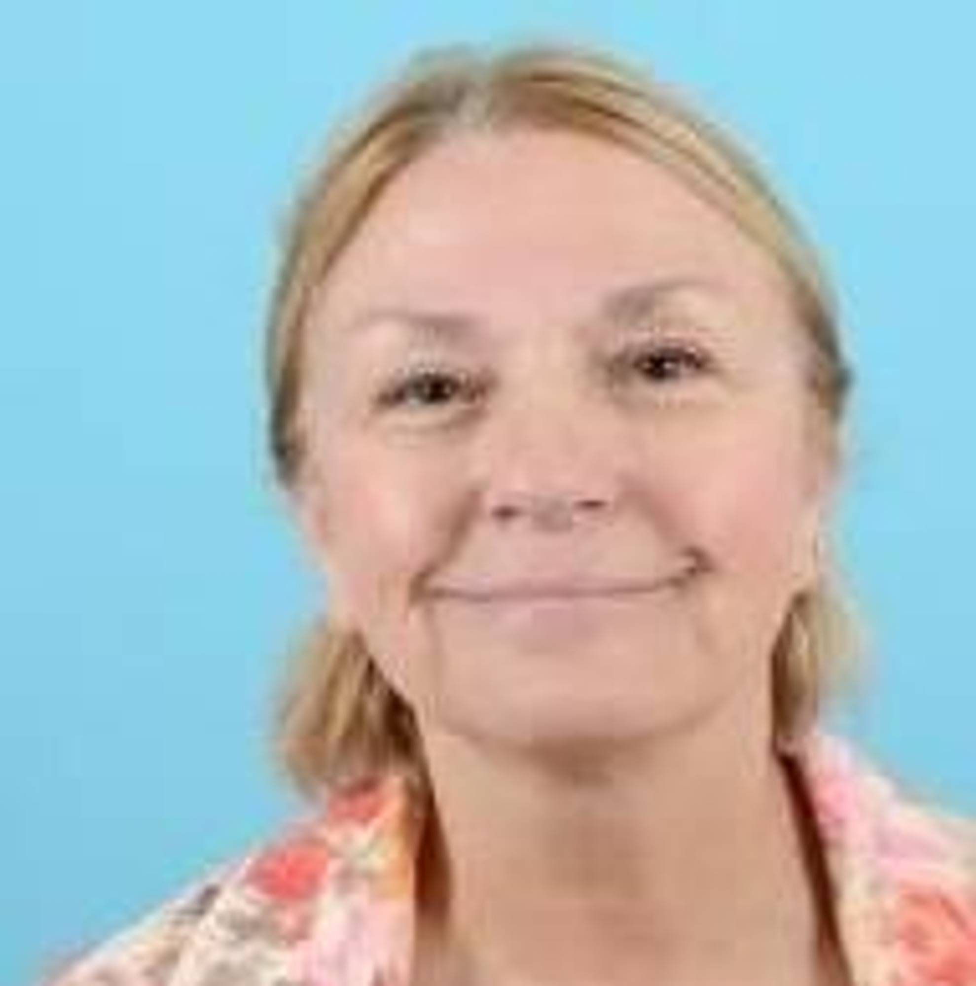 Facelift Before & After Image