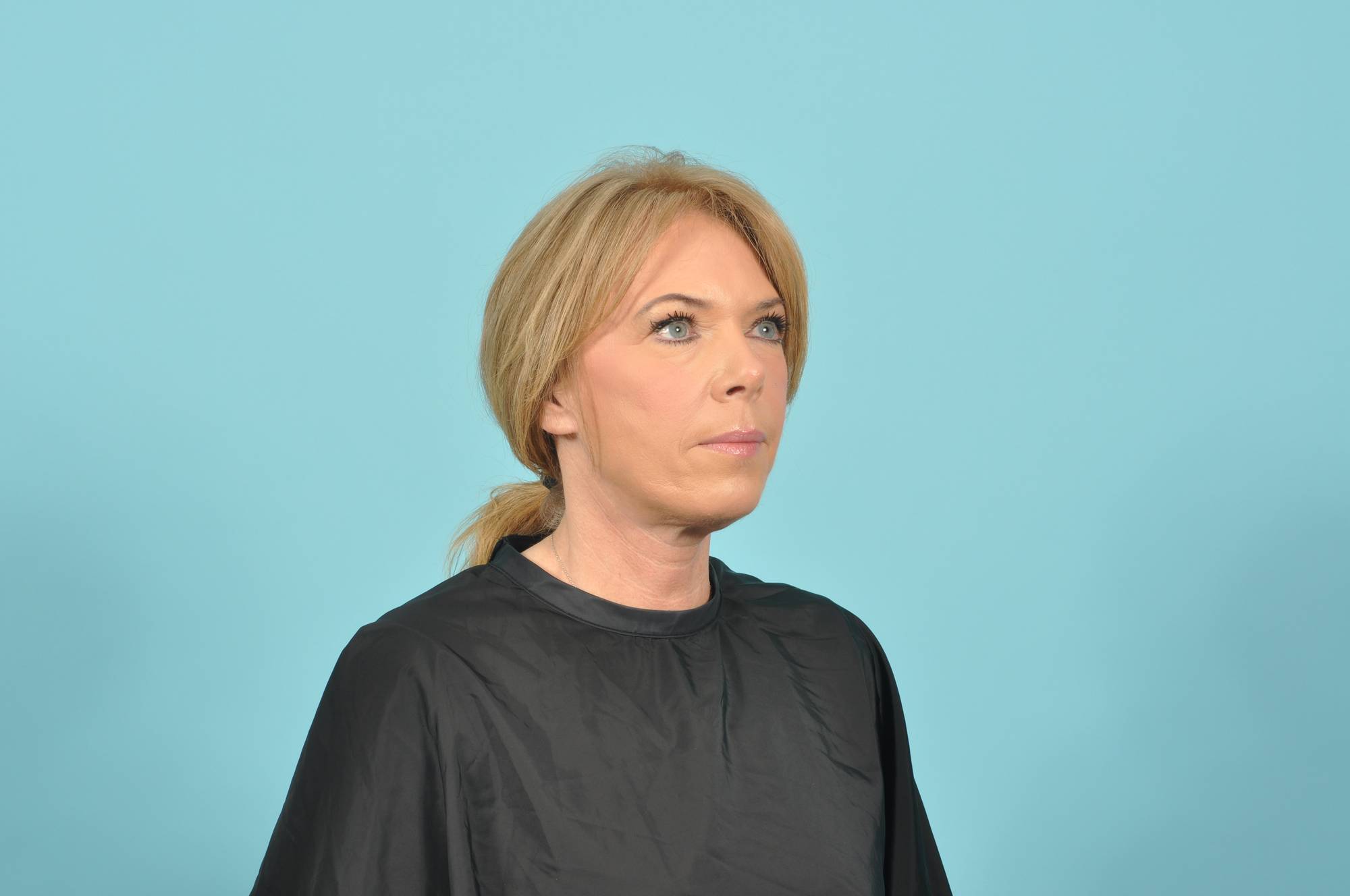  Before & After Image