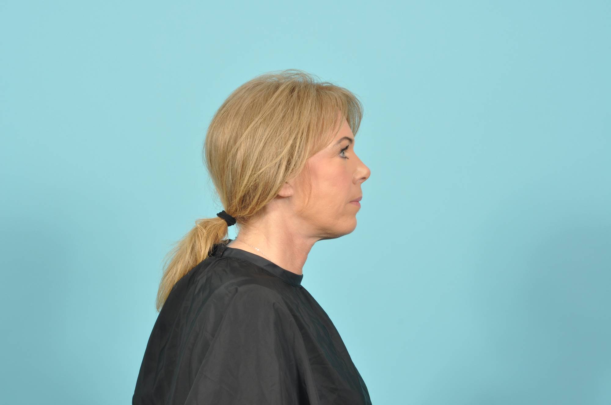  Before & After Image