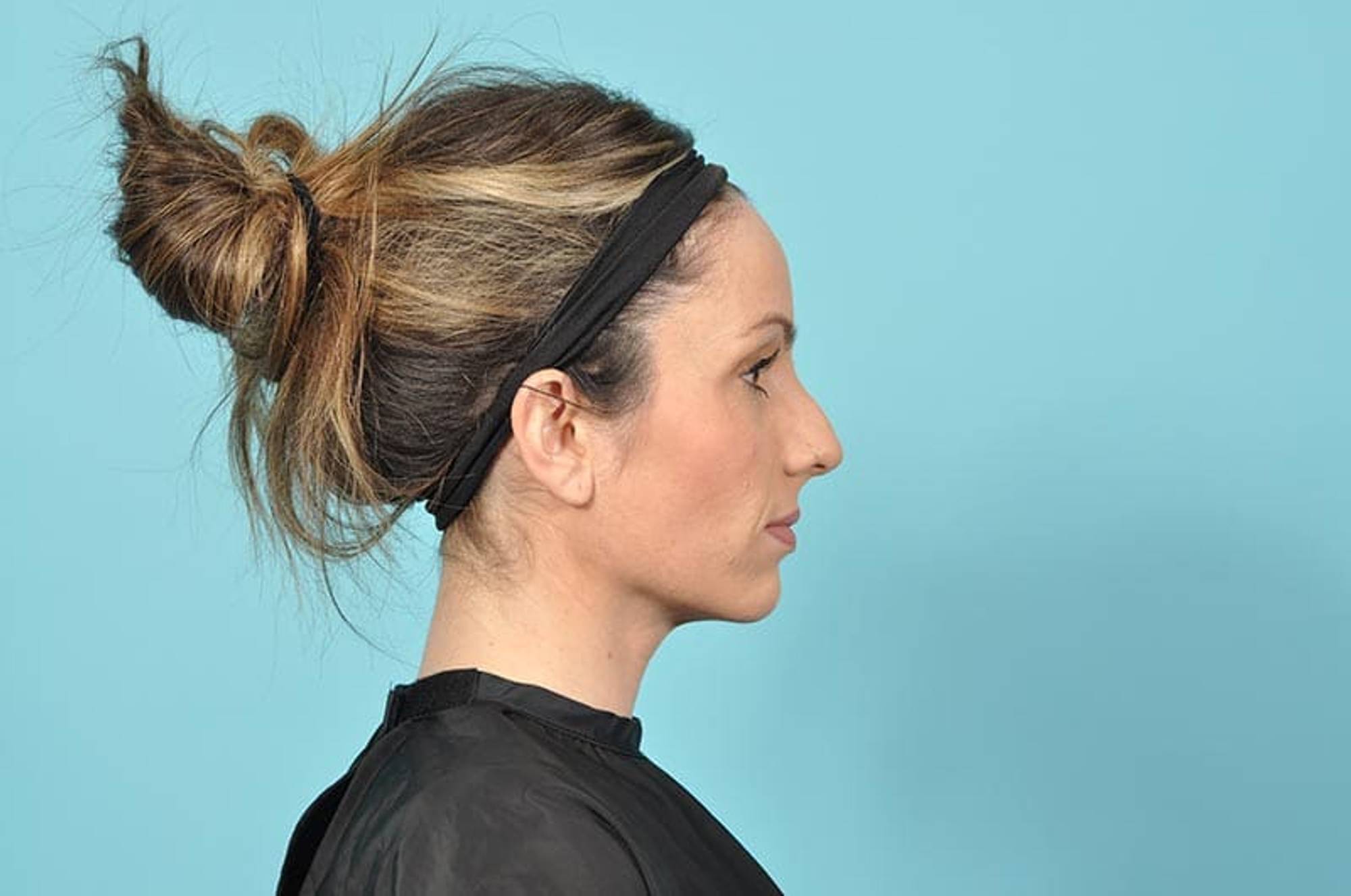  Before & After Image