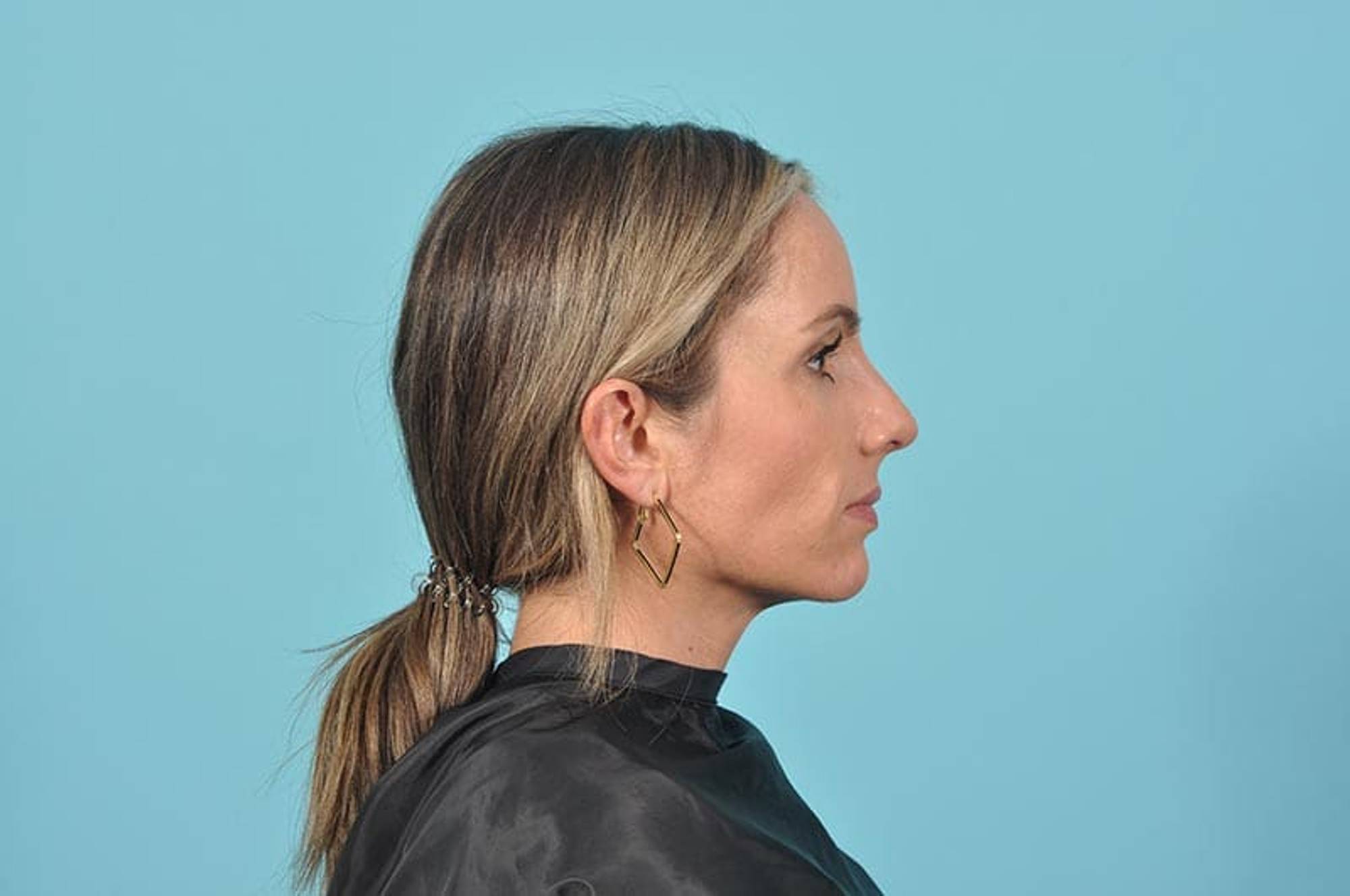  Before & After Image