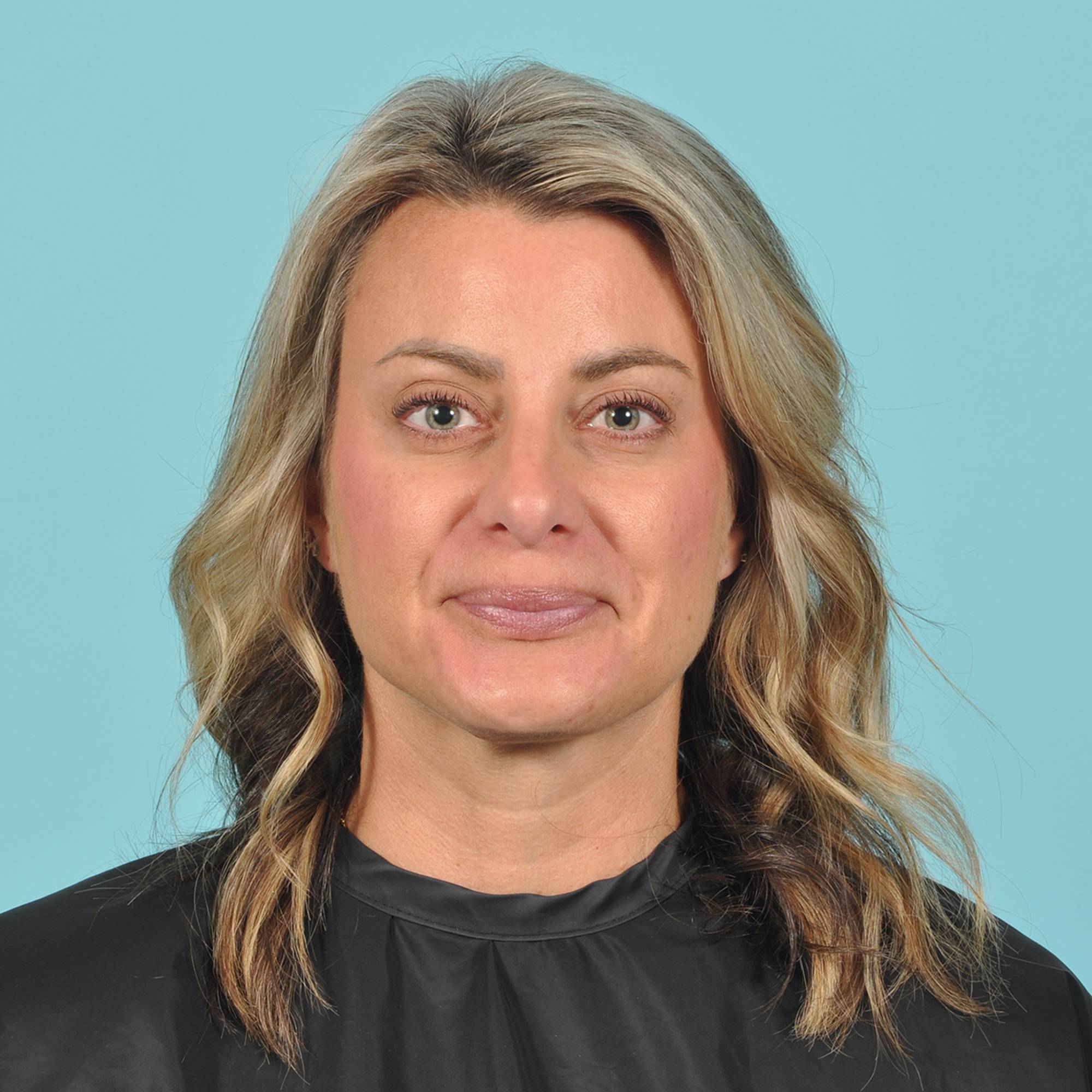 Rhinoplasty Before & After Image