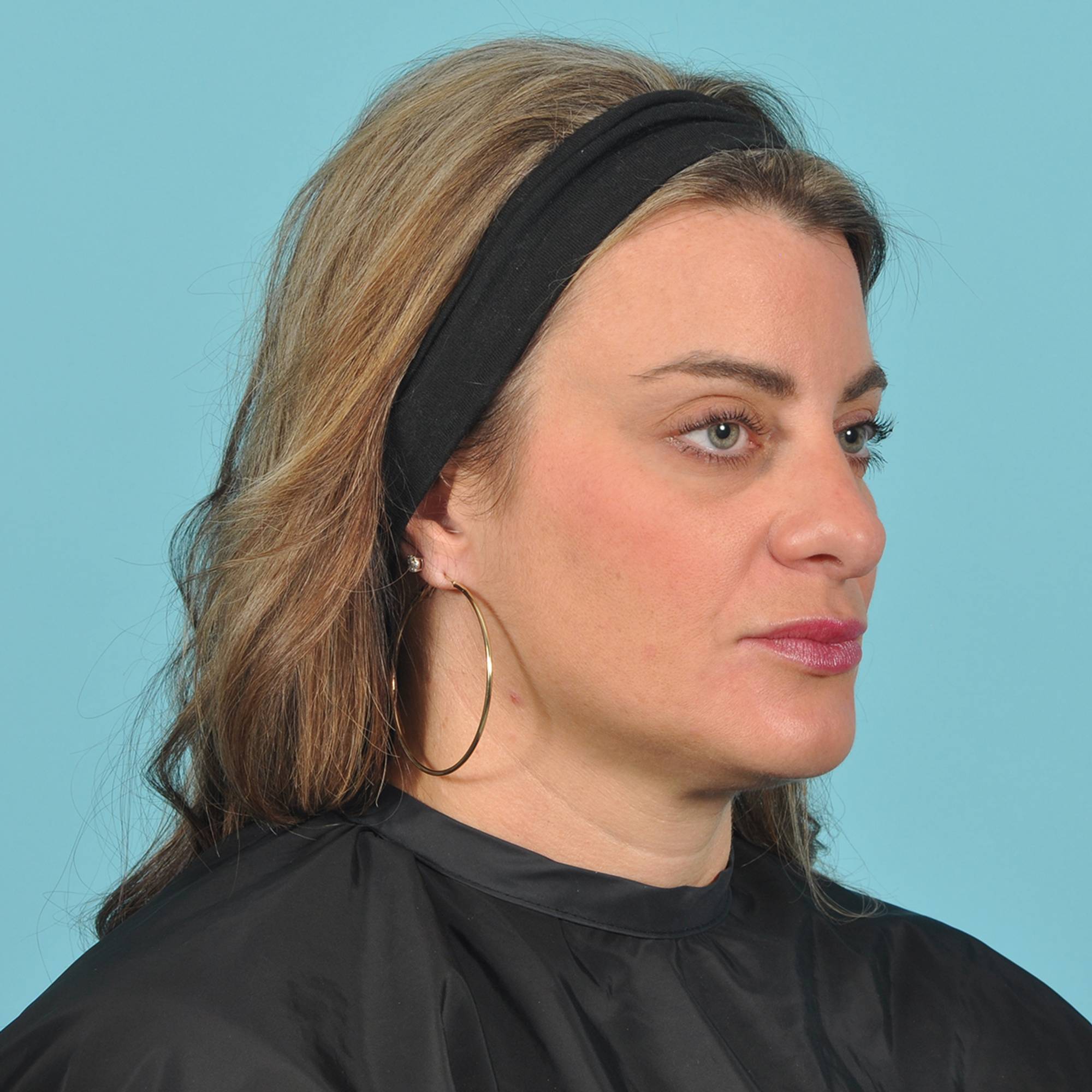  Before & After Image