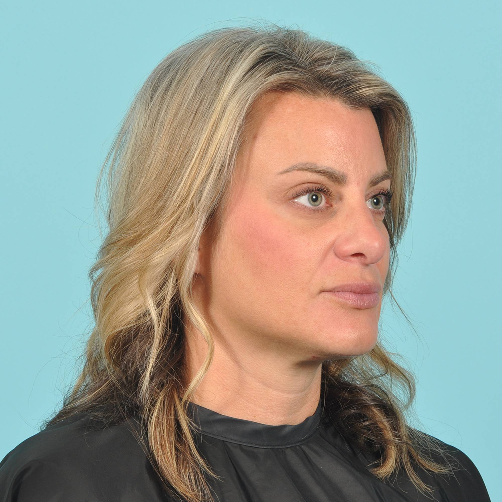  Before & After Image