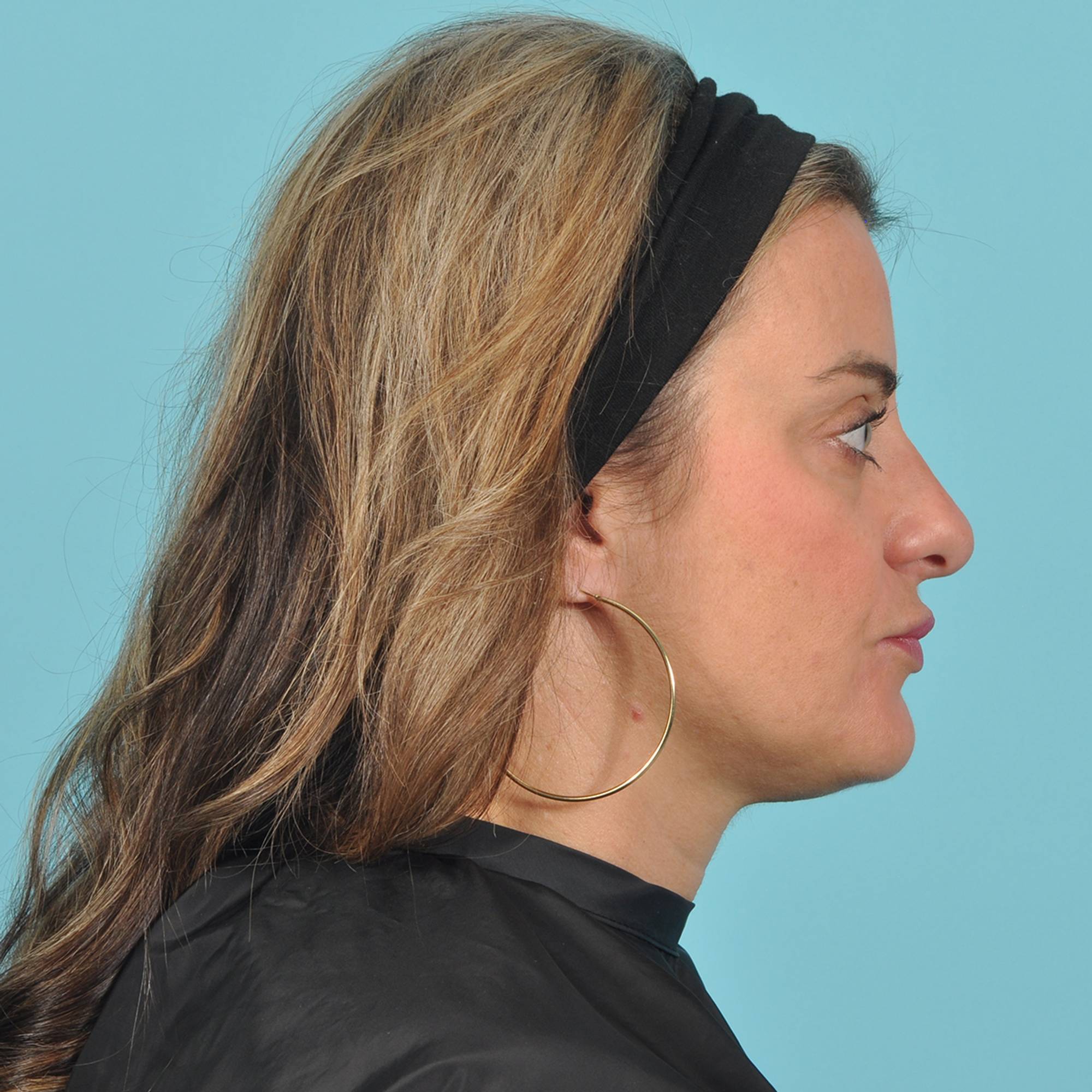  Before & After Image