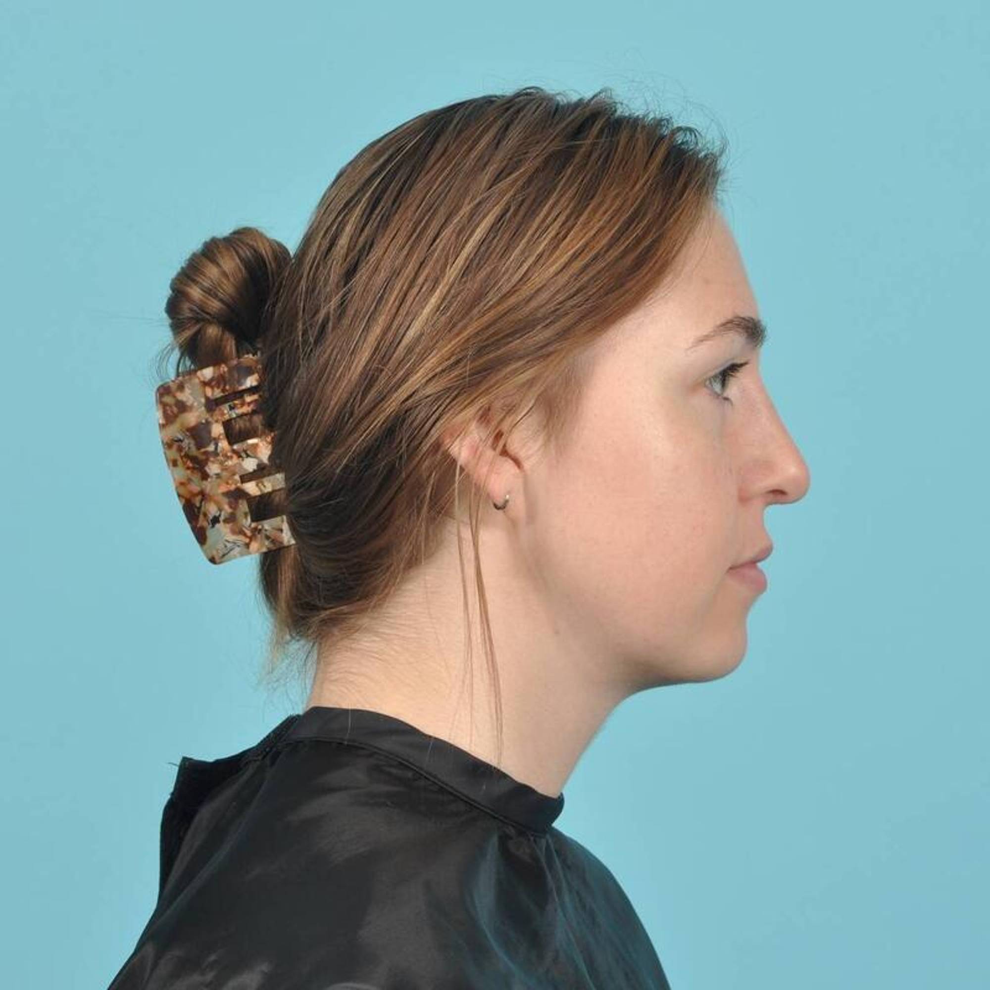  Before & After Image