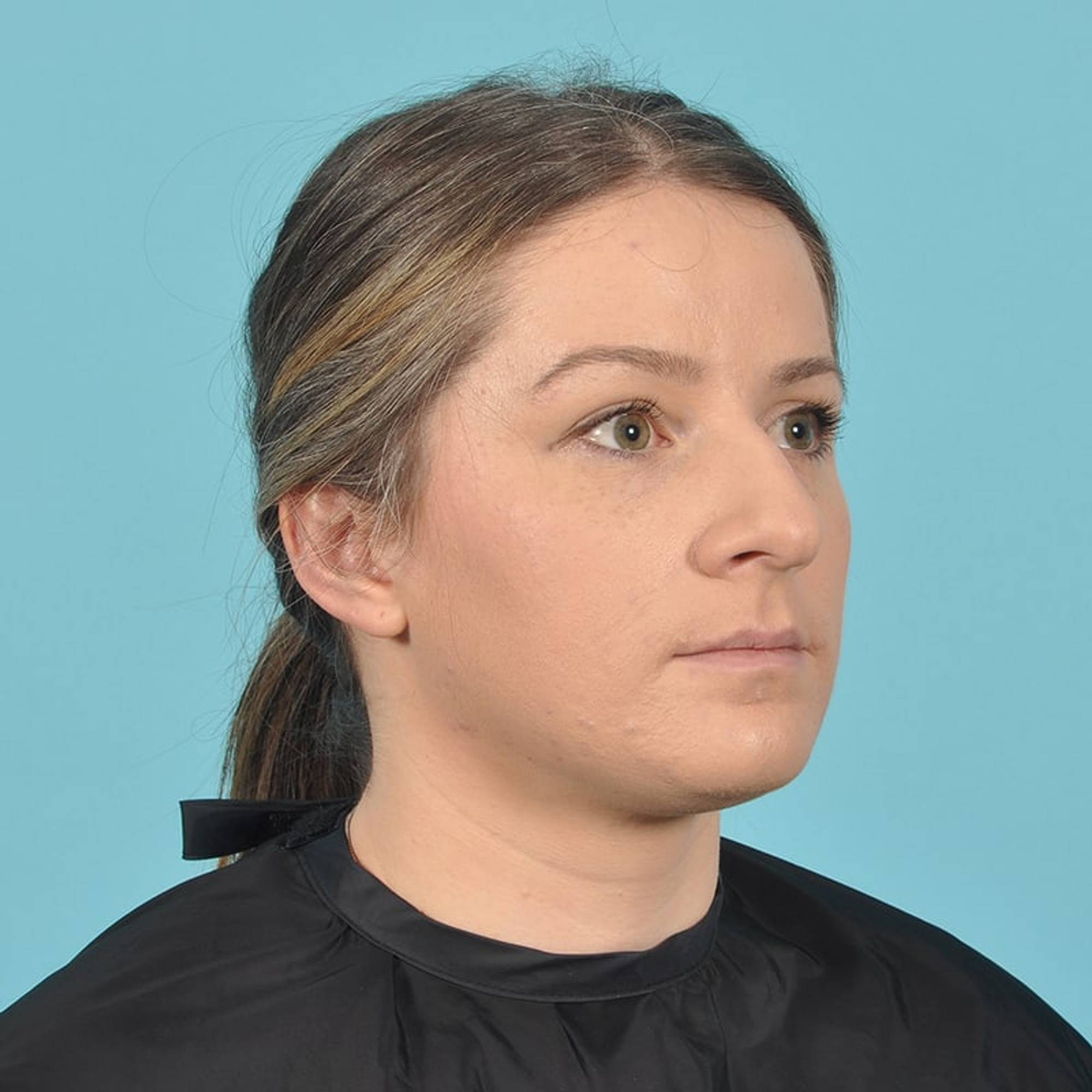  Before & After Image