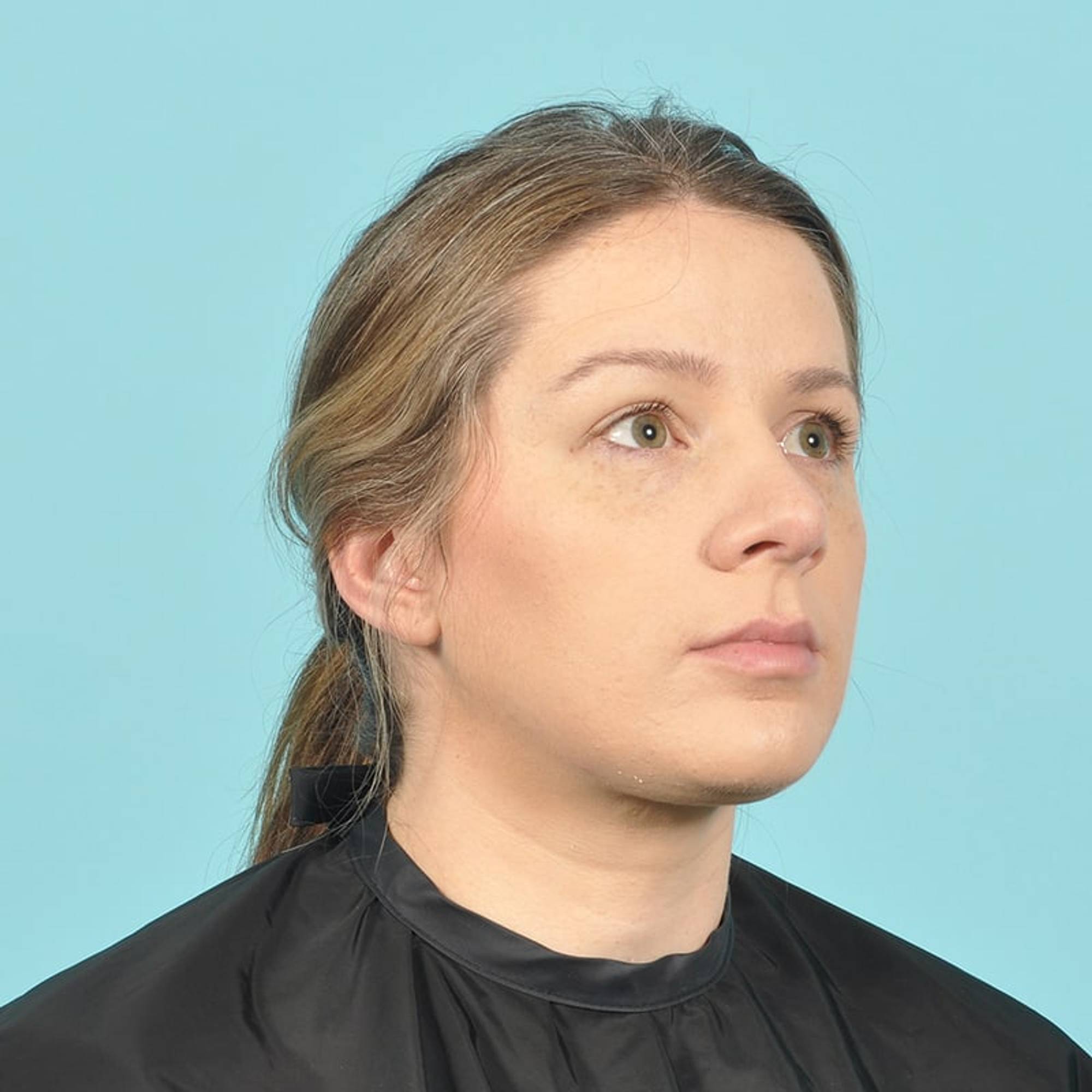  Before & After Image