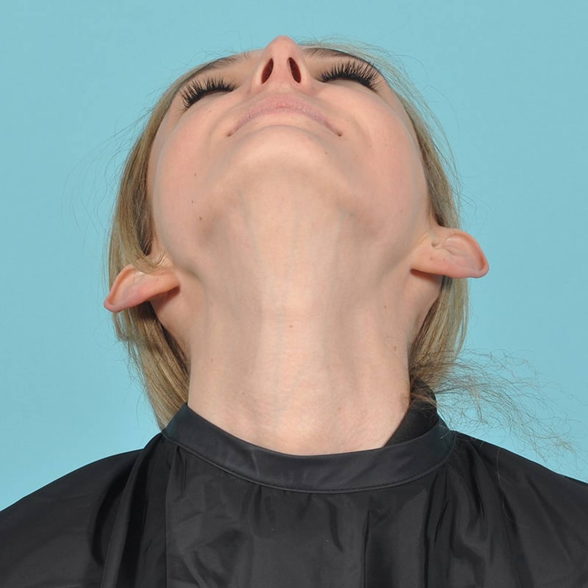  Before & After Image