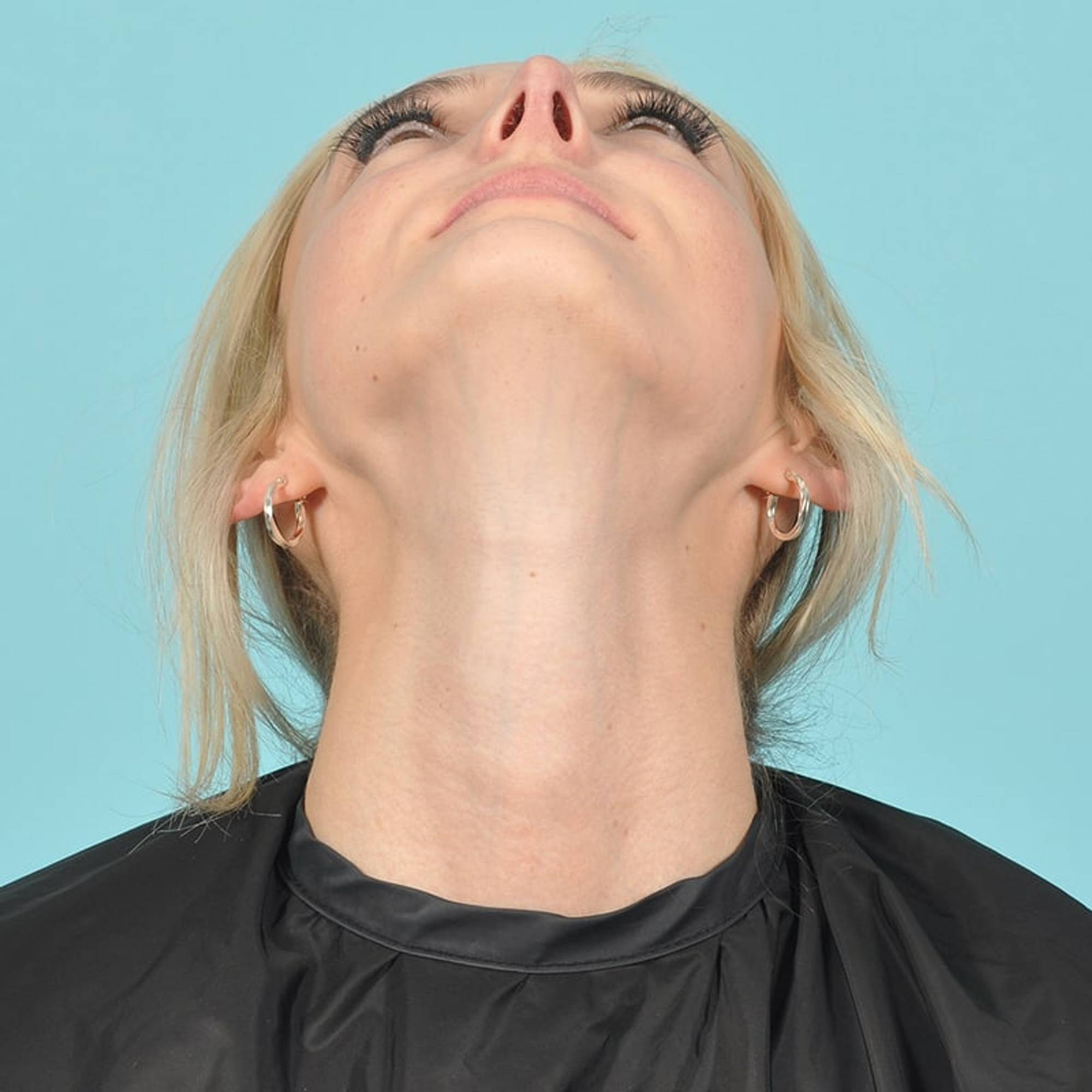  Before & After Image