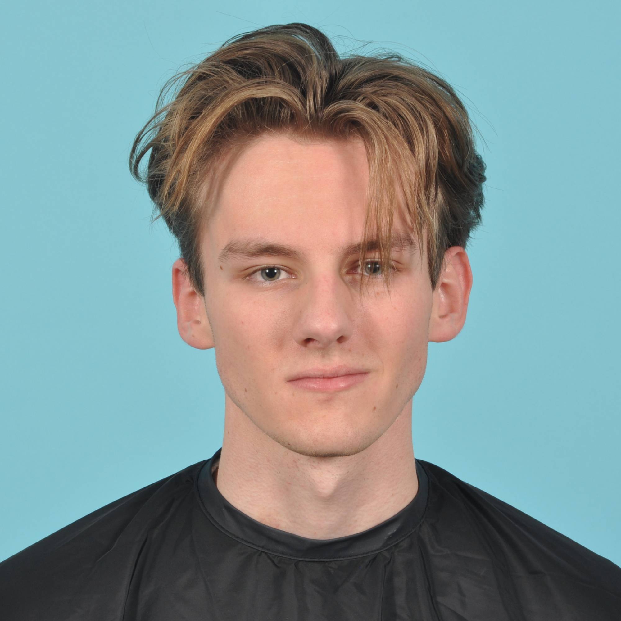 Rhinoplasty Before & After Image