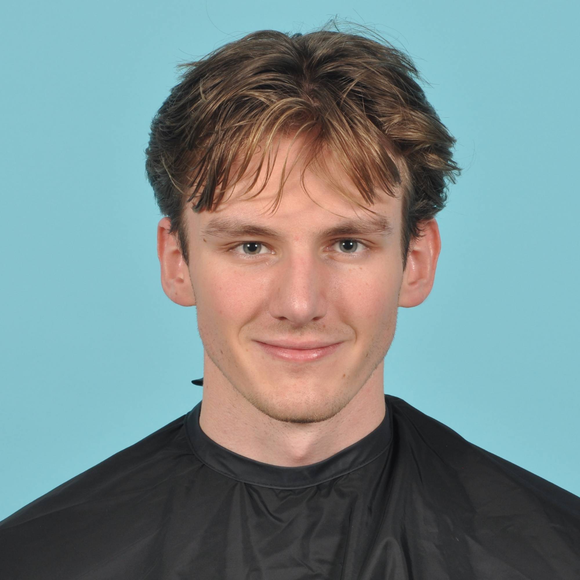 Rhinoplasty Before & After Image