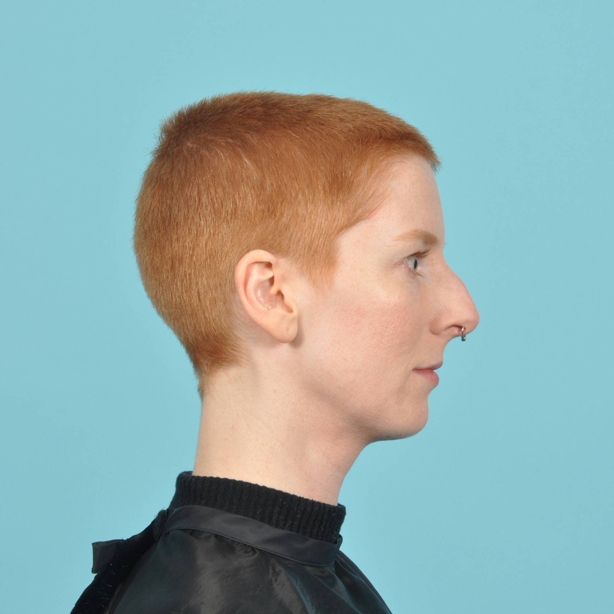  Before & After Image