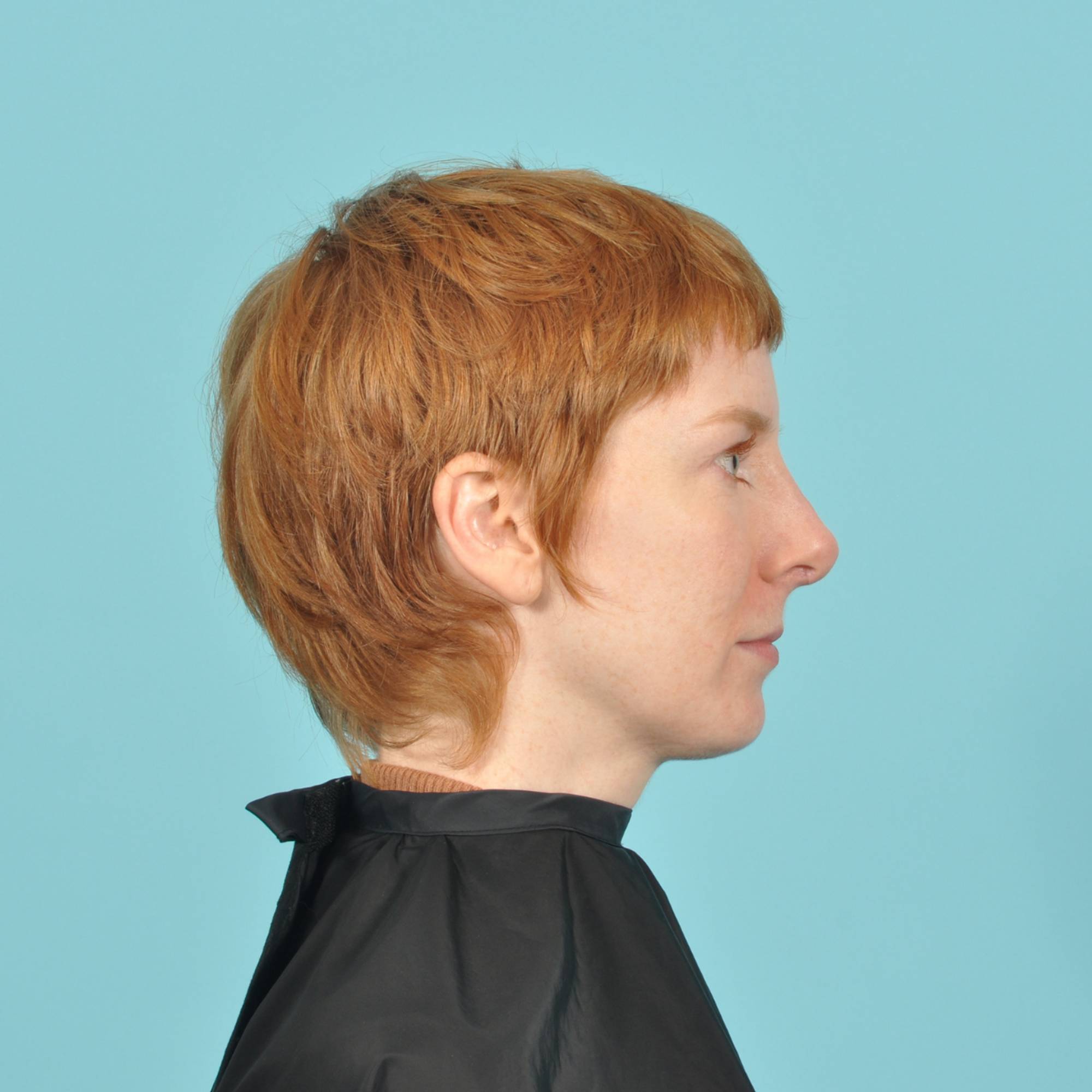  Before & After Image